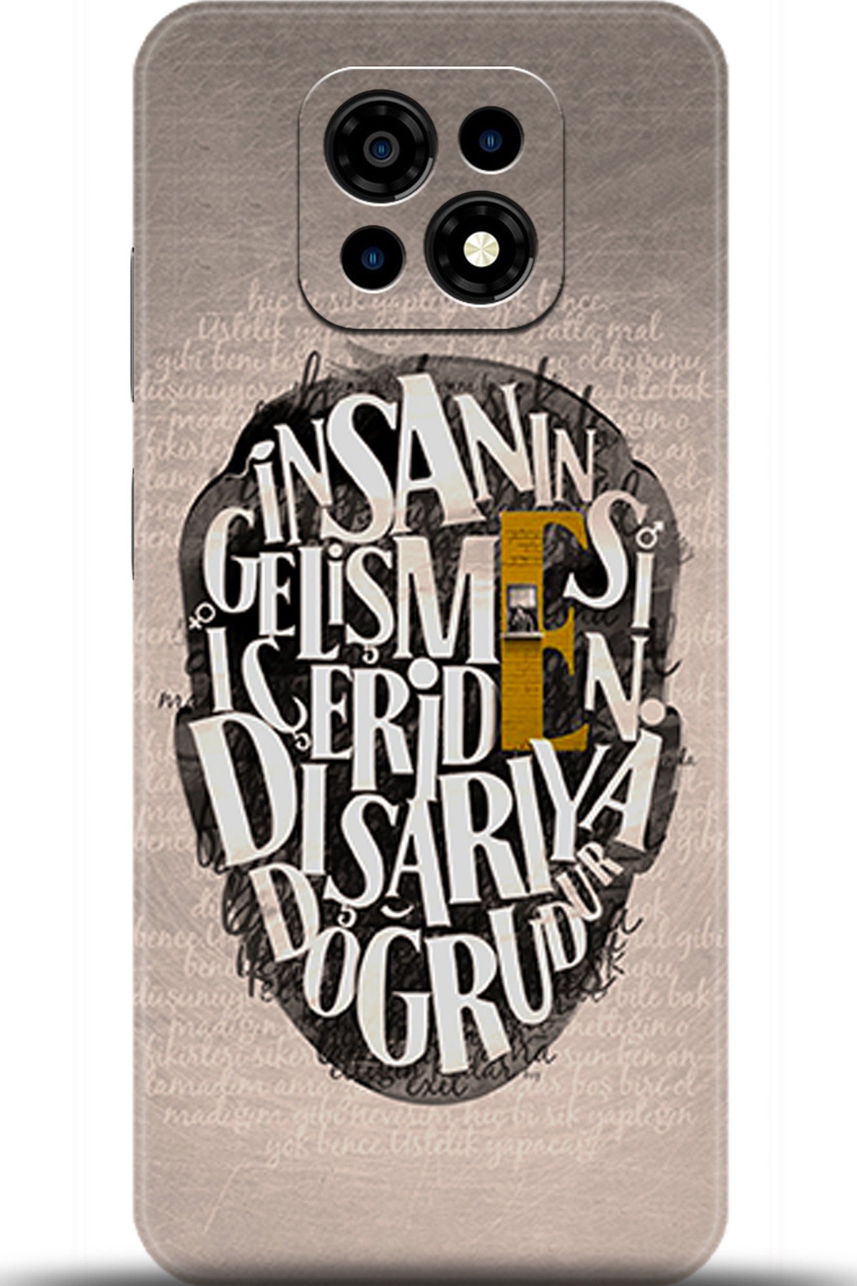 Casper Via M30 Uyumlu Kılıf HD Baskılı Kılıf - Followed Institution 5587