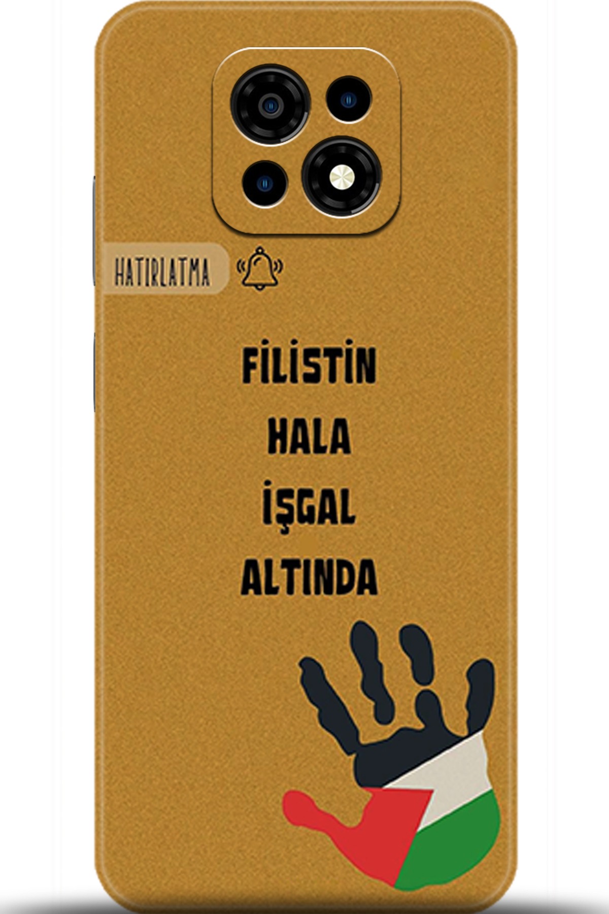 Casper Via M30 Uyumlu Kılıf HD Baskılı Kılıf - Followed Institution 5740