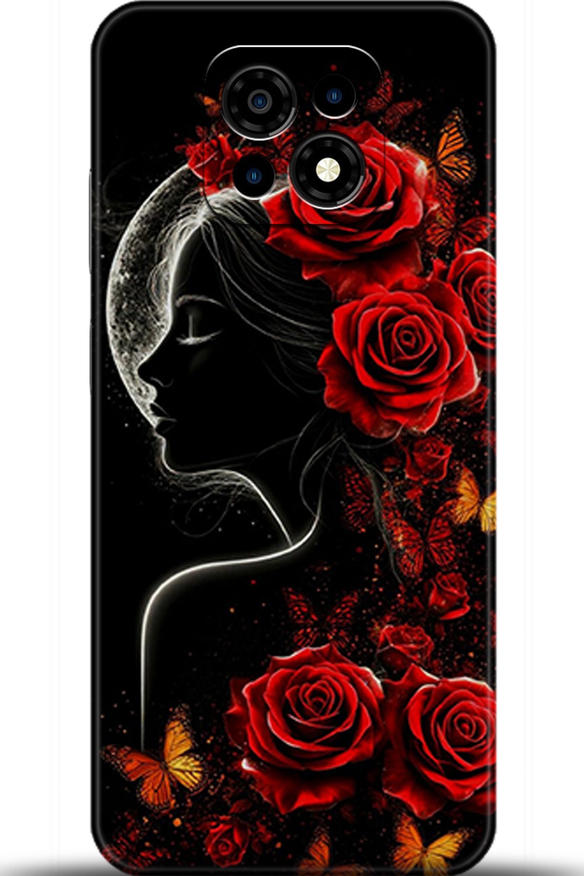 Casper Via M30 Uyumlu Kılıf HD Baskılı Kılıf - Followed Institution 5863