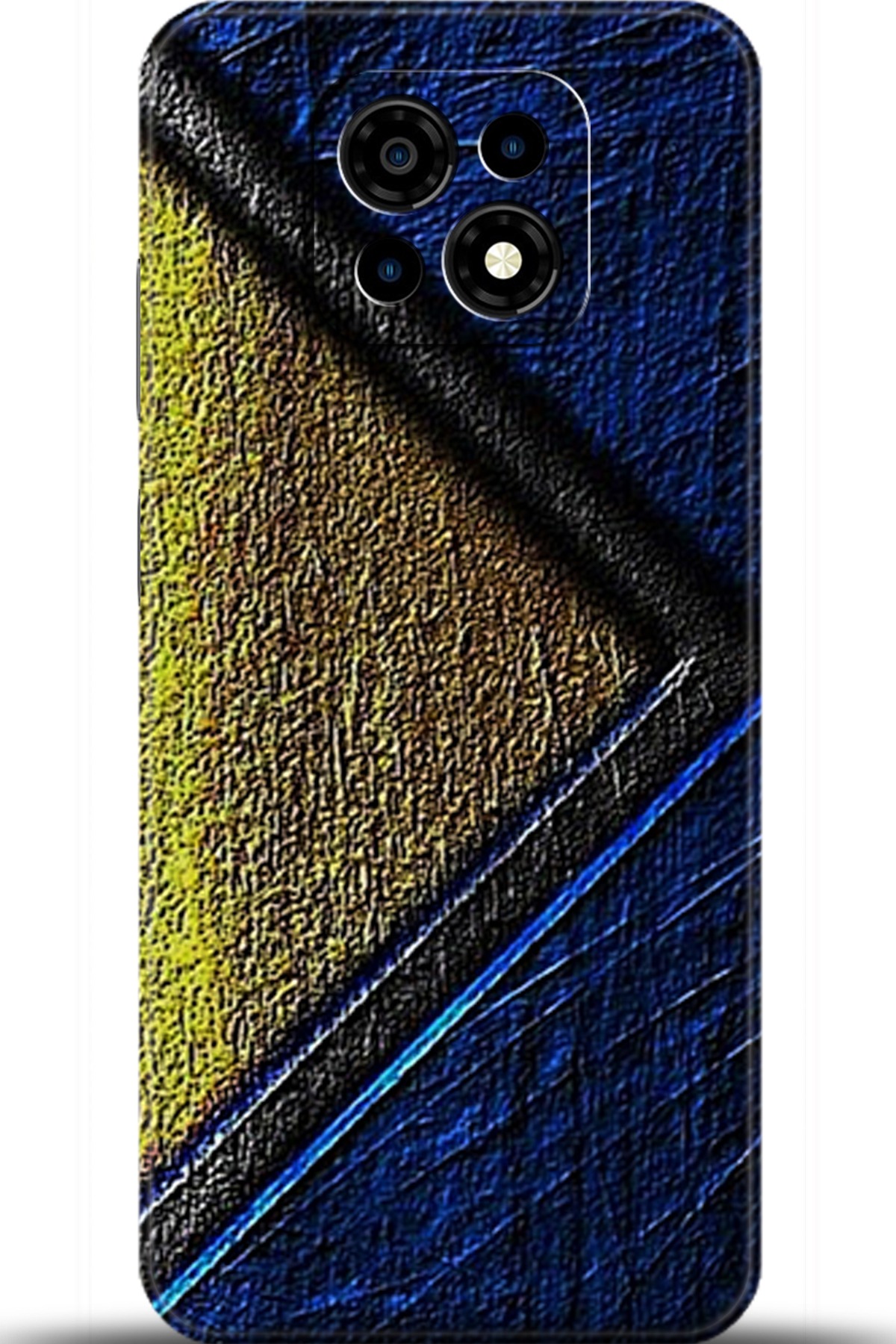 Casper Via M30 Uyumlu Kılıf HD Baskılı Kılıf - Followed Institution 5877