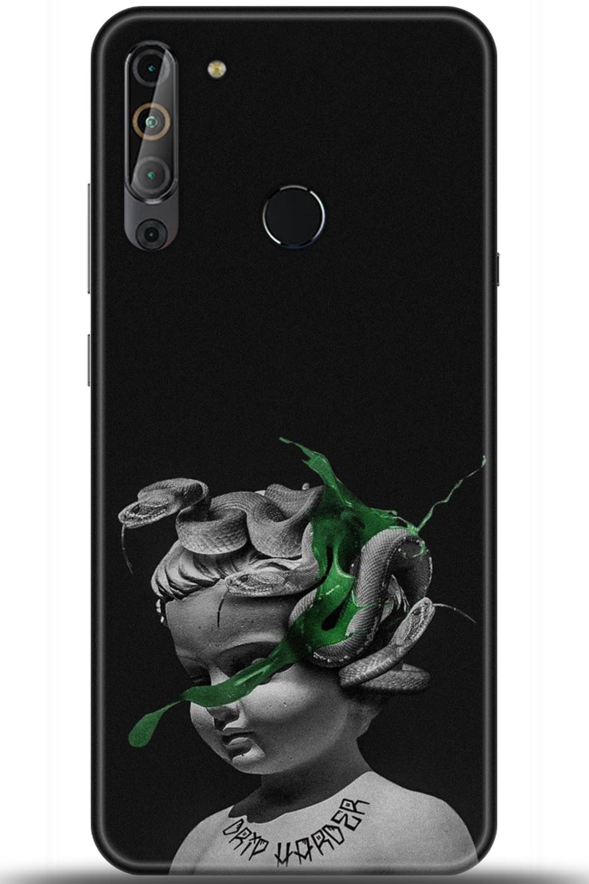 Casper Via X20 Uyumlu Kılıf HD Baskılı Kılıf - Followed Institution 5077