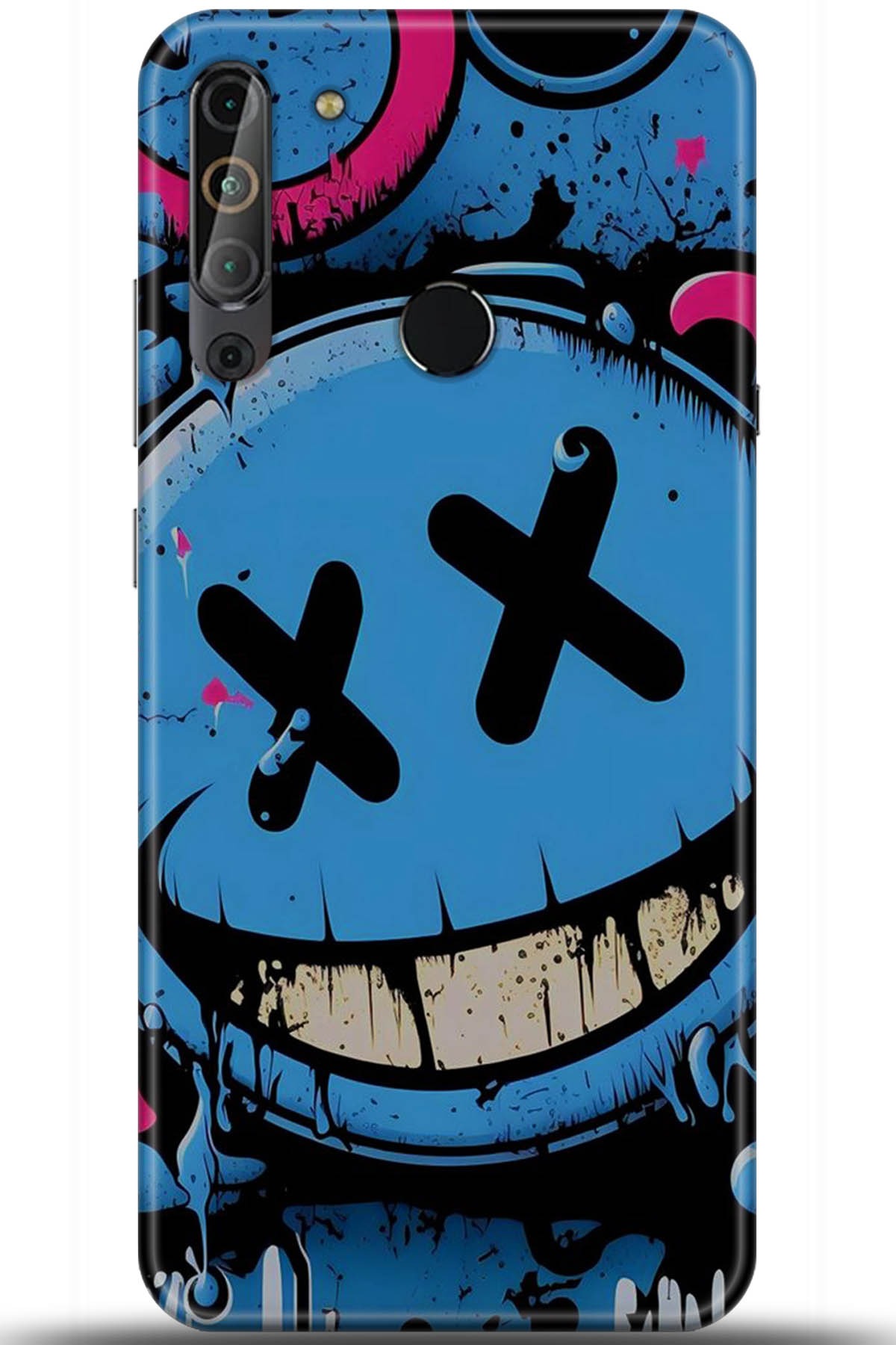 Casper Via X20 Uyumlu Kılıf HD Baskılı Kılıf - Followed Institution 5261