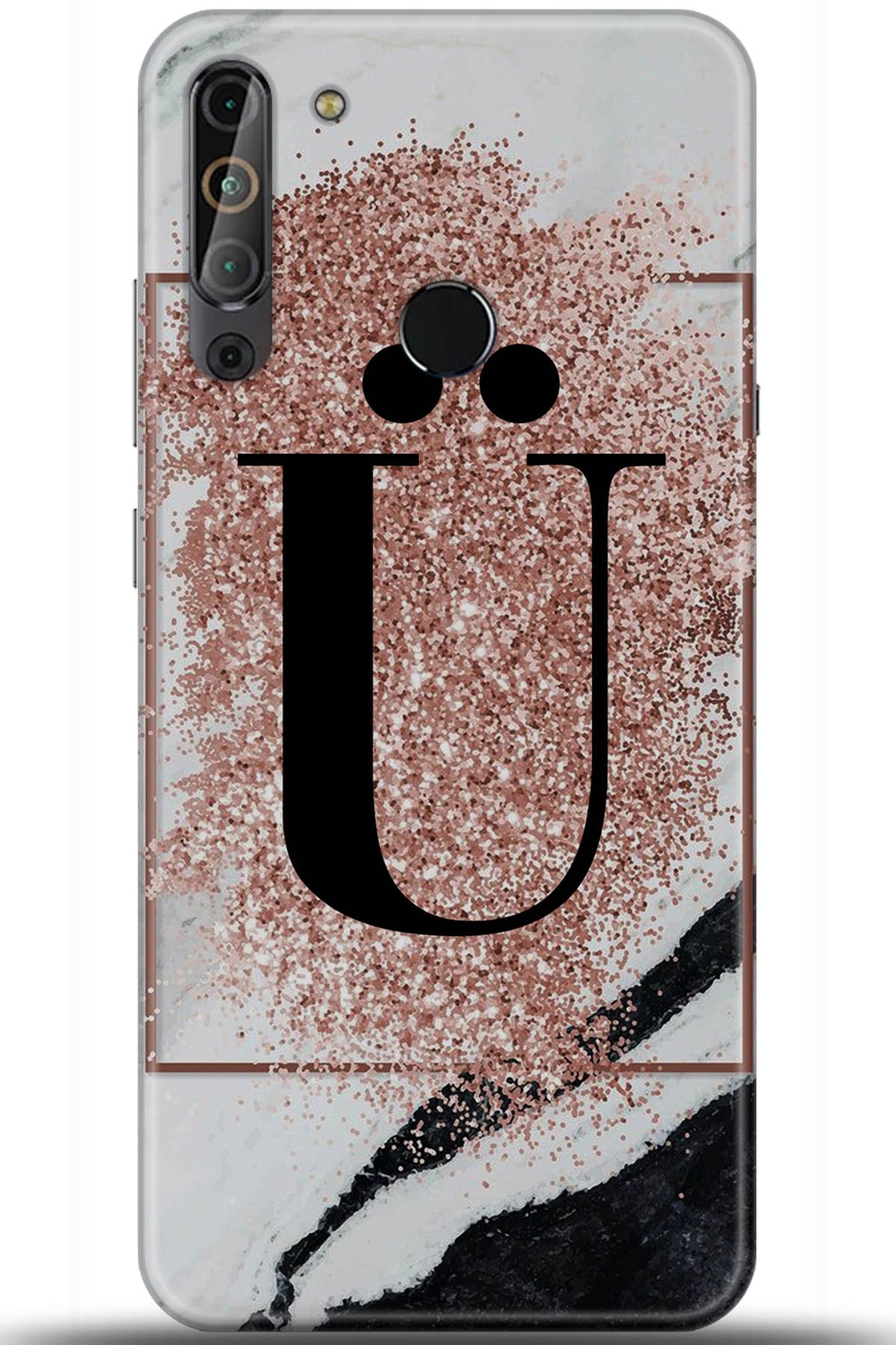 Casper Via X20 Uyumlu Kılıf HD Baskılı Kılıf - Followed Institution 5996