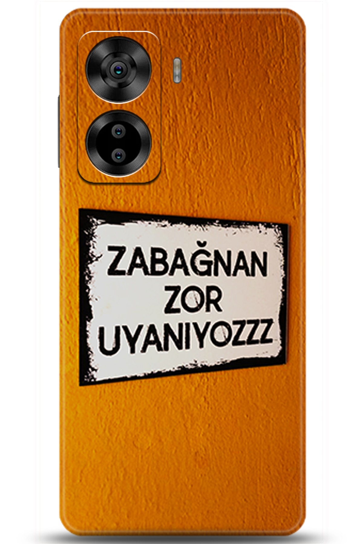 Casper Via X40 Uyumlu Kılıf HD Baskılı Kılıf - Followed Institution 5590