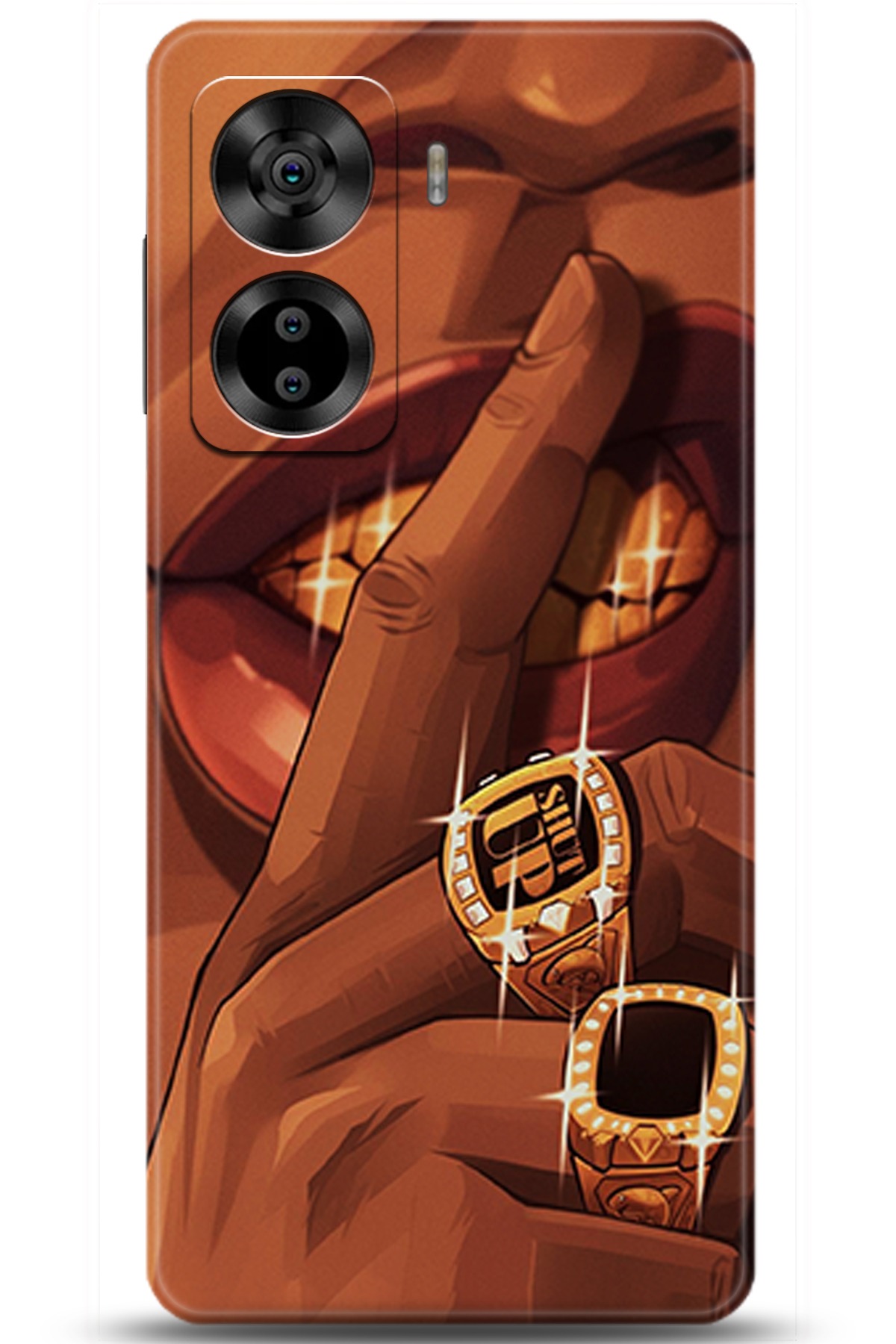 Casper Via X40 Uyumlu Kılıf HD Baskılı Kılıf - Followed Institution 5631