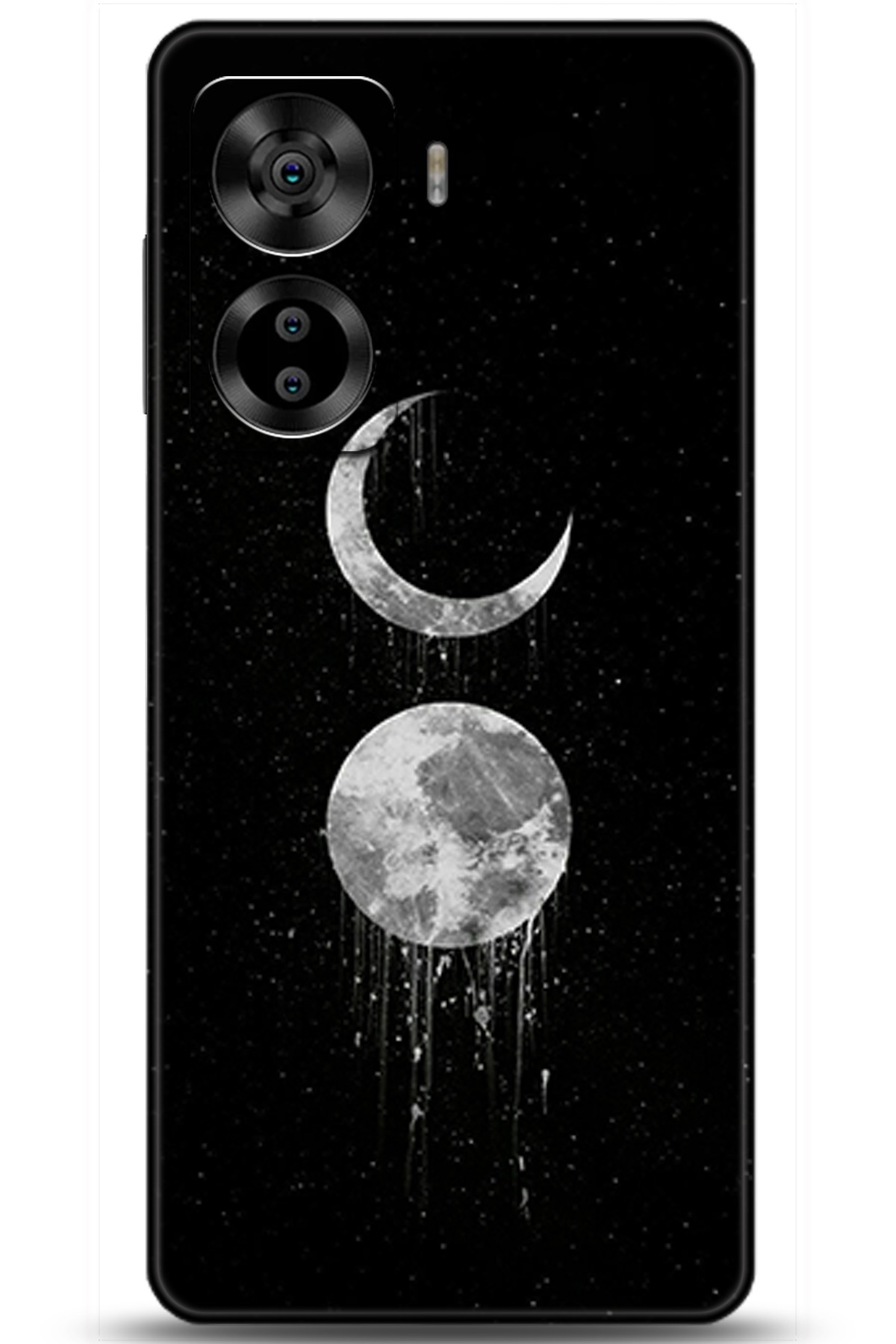 Casper Via X40 Uyumlu Kılıf HD Baskılı Kılıf - Followed Institution 5788