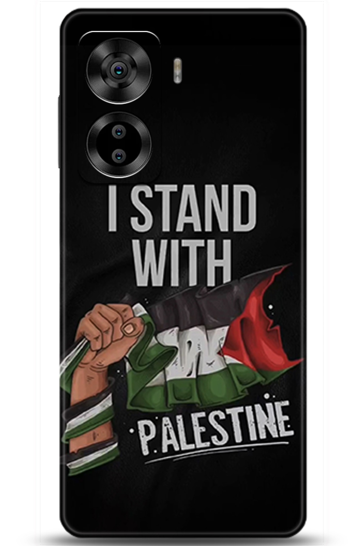 Casper Via X40 Uyumlu Kılıf HD Baskılı Kılıf - Followed Institution 5804