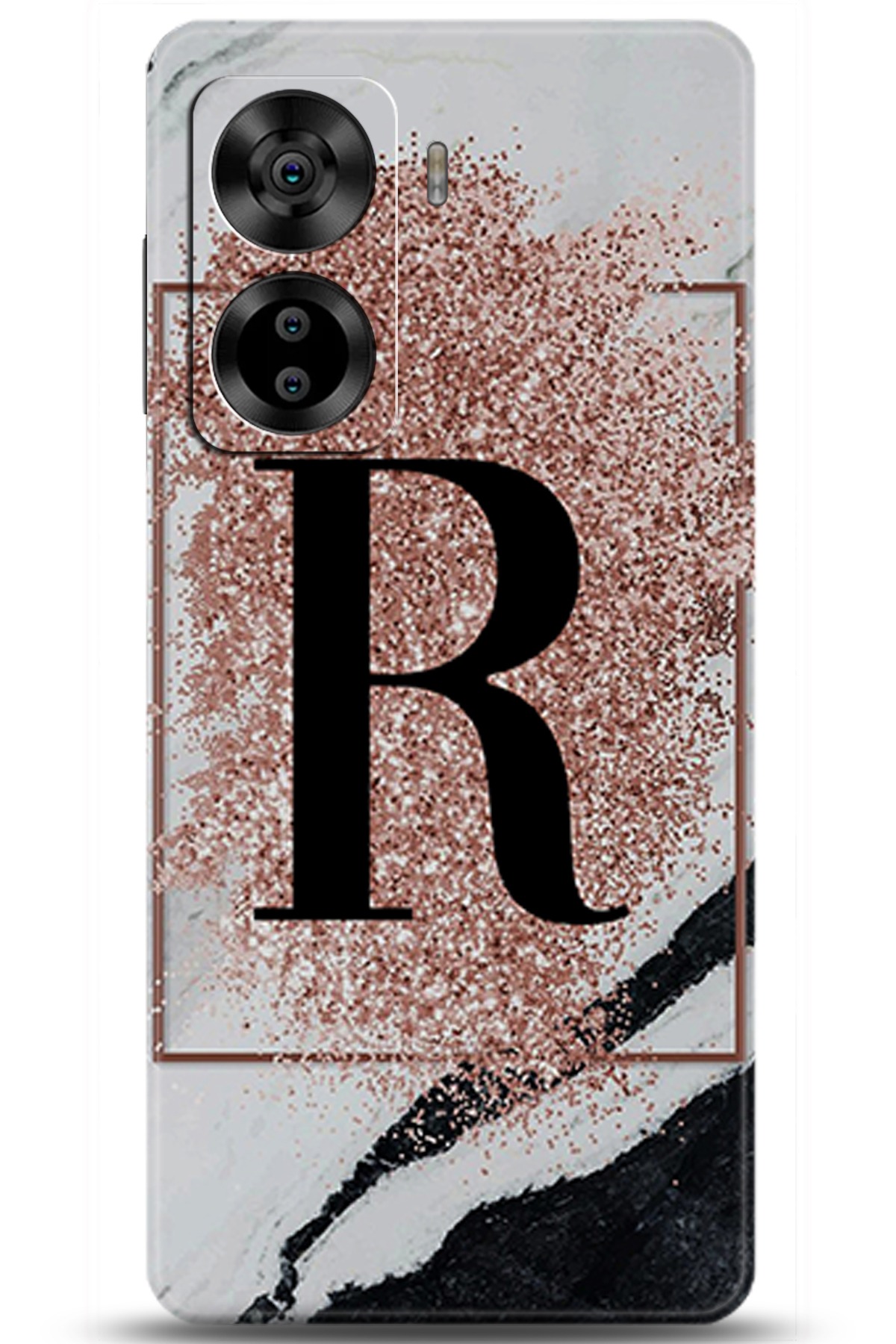 Casper Via X40 Uyumlu Kılıf HD Baskılı Kılıf - Followed Institution 6001