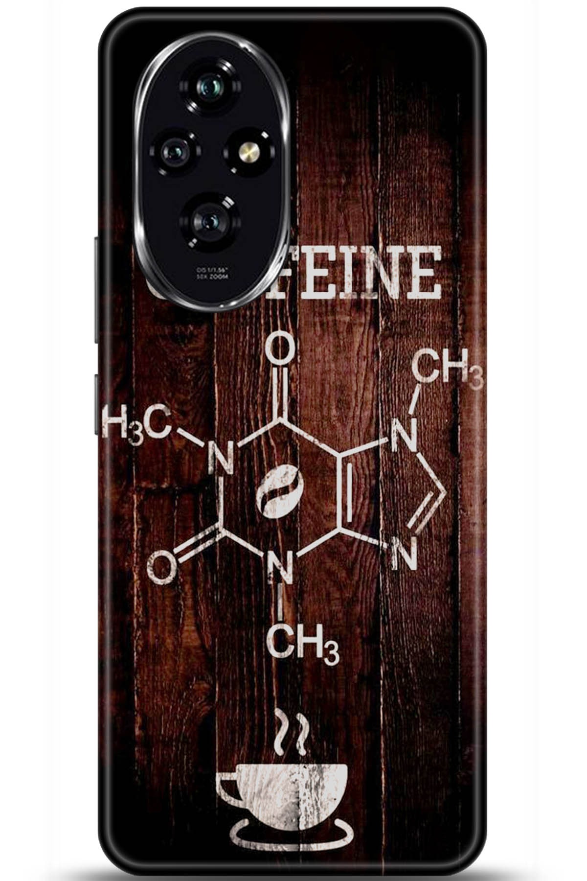 Honor 200 Uyumlu Kılıf HD Baskılı Kılıf - Followed Institution 5501