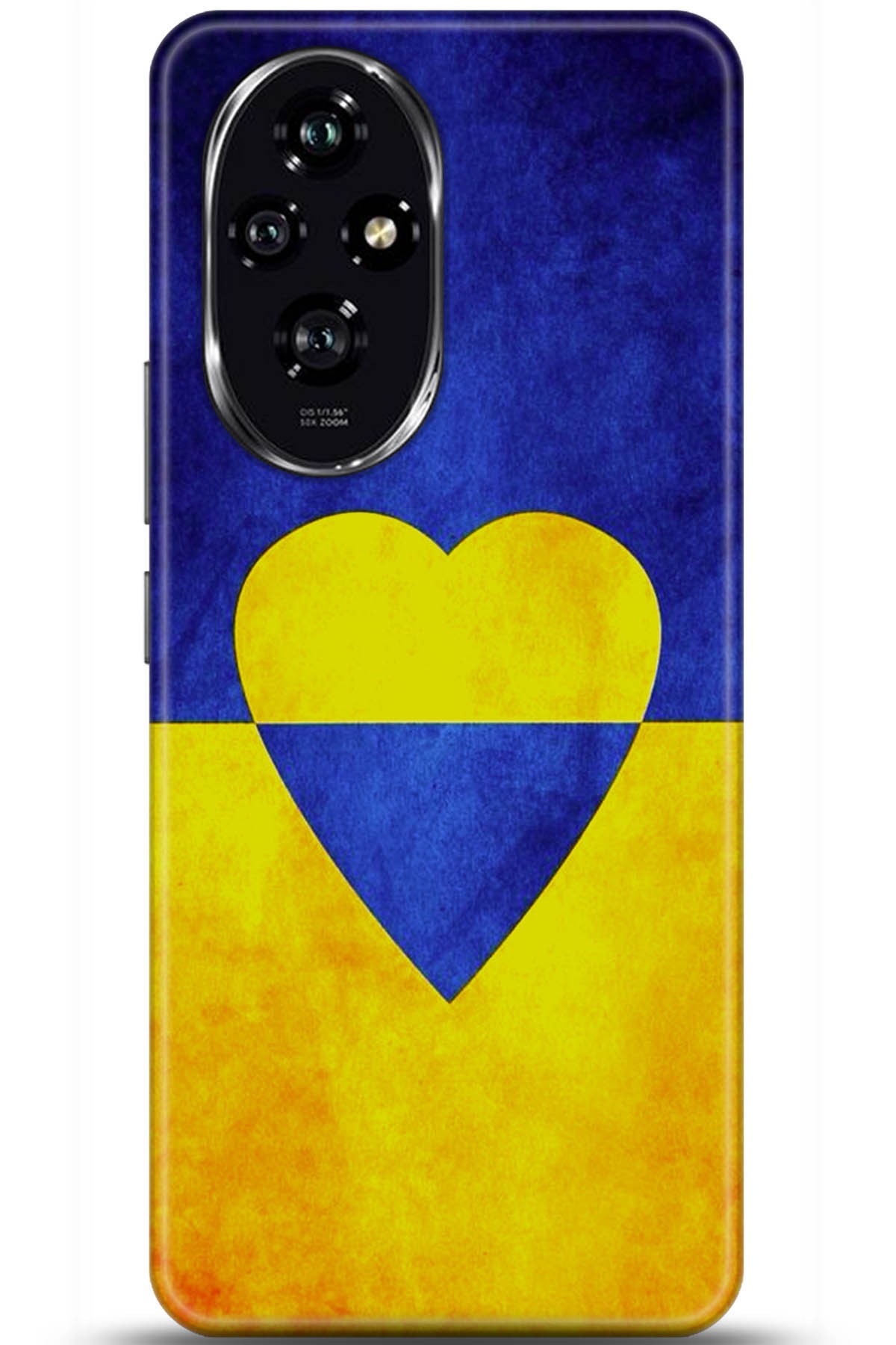 Honor 200 Uyumlu Kılıf HD Baskılı Kılıf - Followed Institution 5581