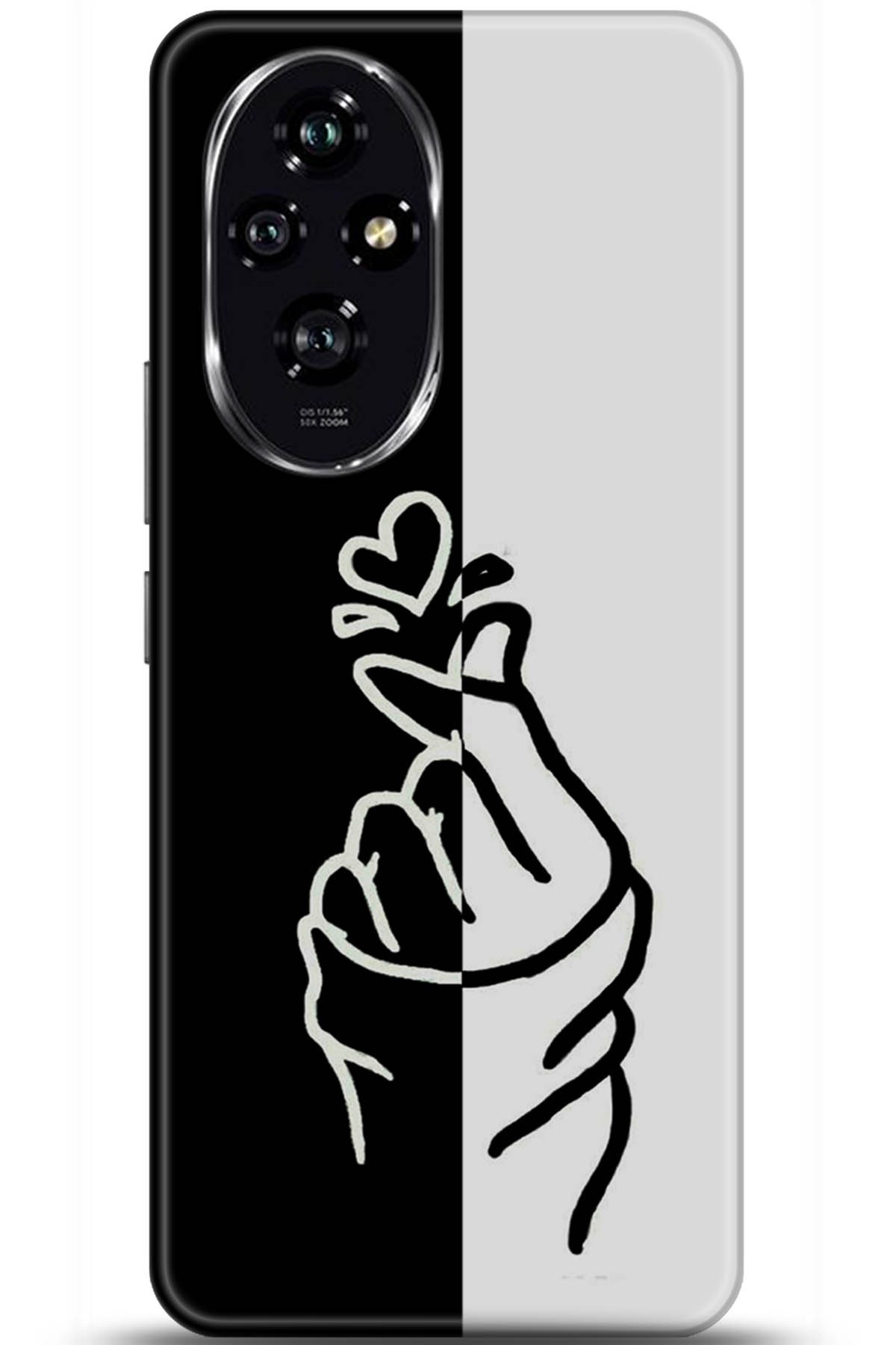 Honor 200 Uyumlu Kılıf HD Baskılı Kılıf - Followed Institution 5918