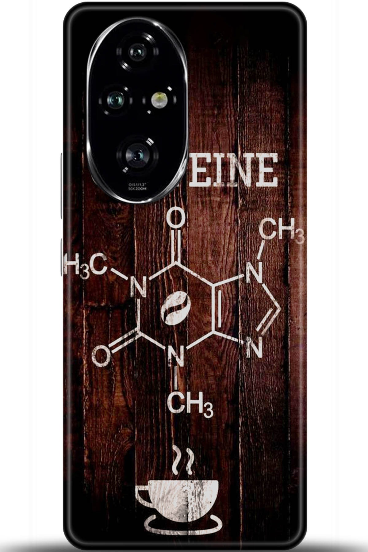 Honor 200 Pro Uyumlu Kılıf HD Baskılı Kılıf - Followed Institution 5501