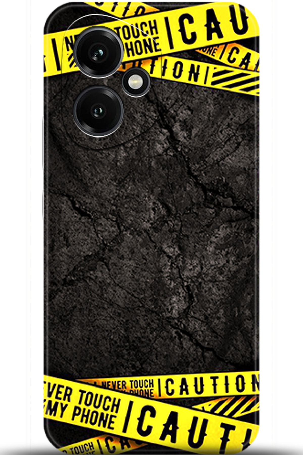 Honor 400 Uyumlu Kılıf HD Baskılı Kılıf - Followed Institution 5514