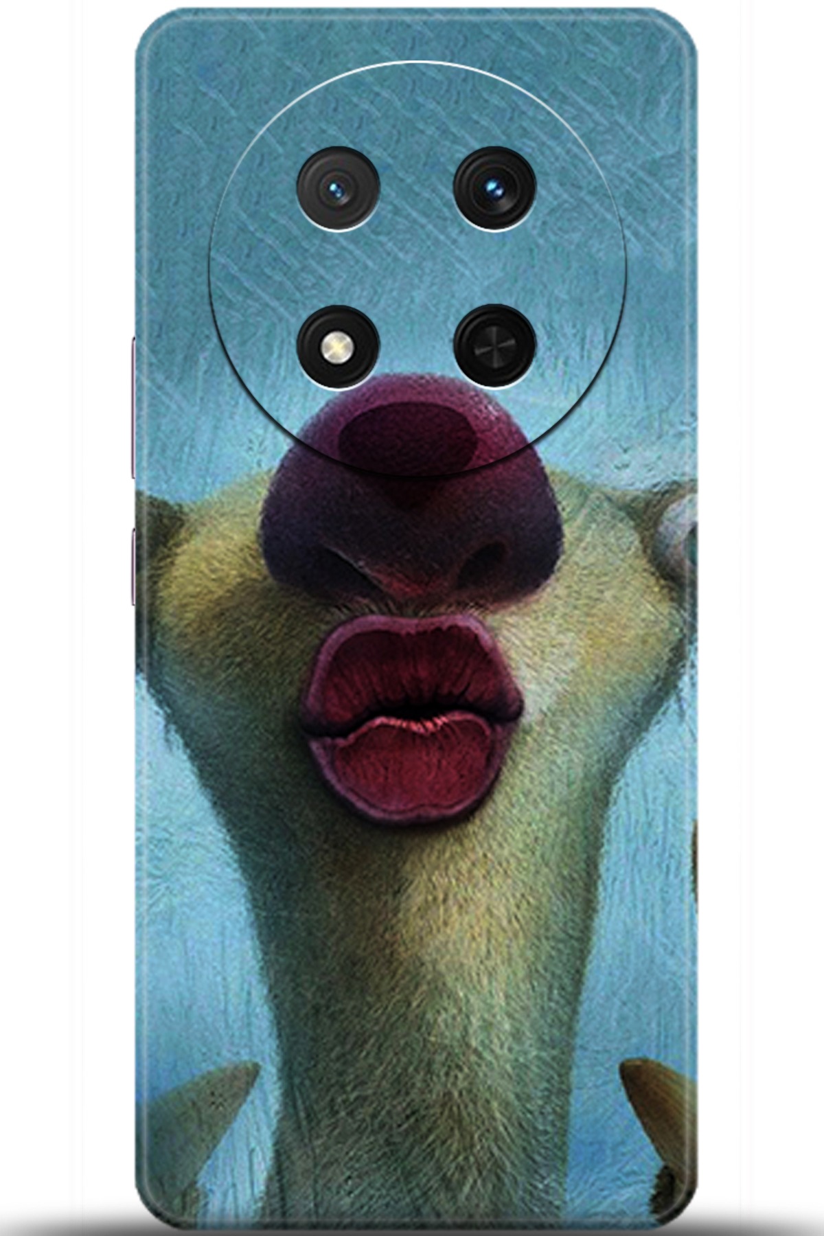 Honor Magic7 Lite Kılıf HD Baskılı Kılıf - Followed Institution 5372