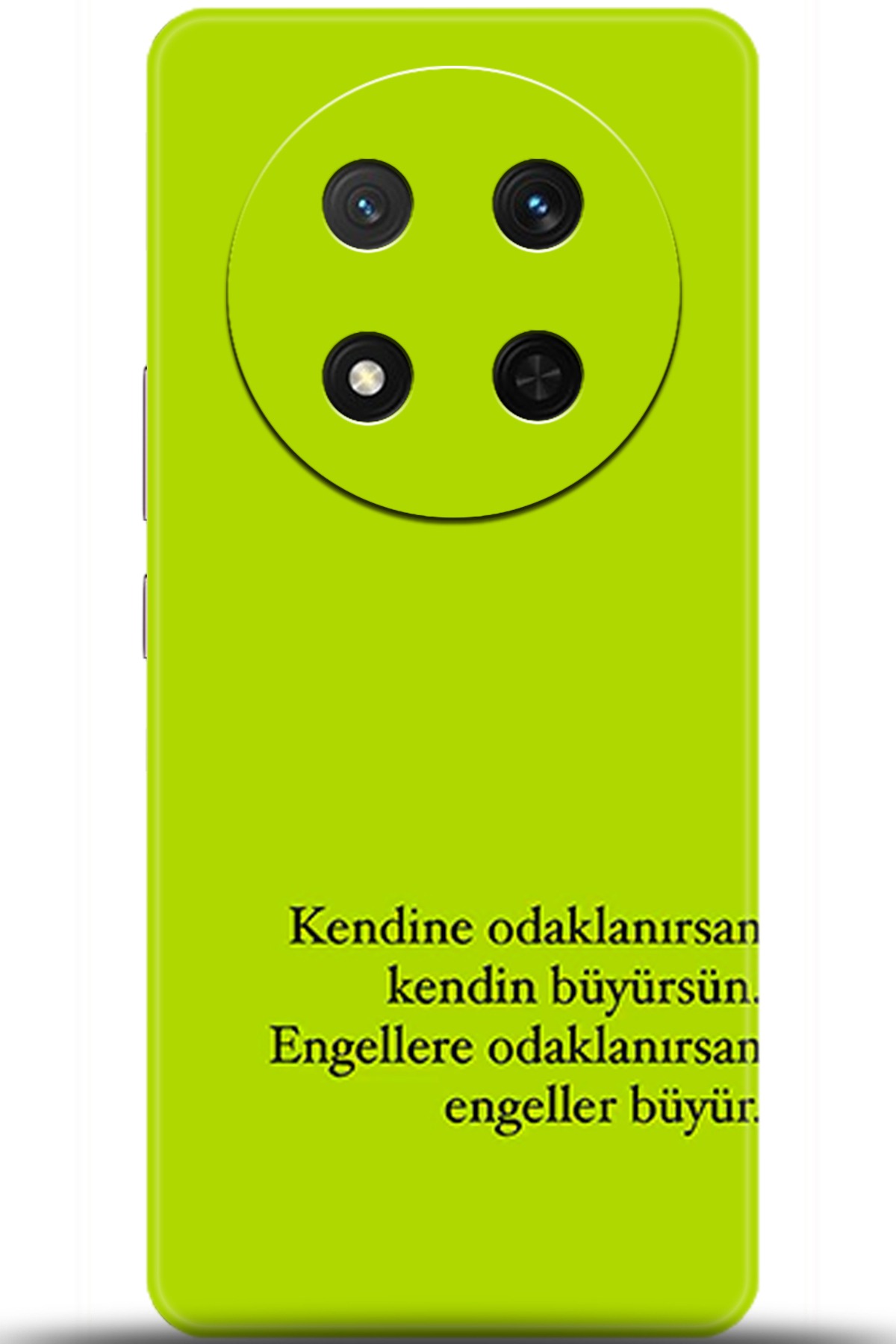 Honor Magic7 Lite Kılıf HD Baskılı Kılıf - Followed Institution 5593