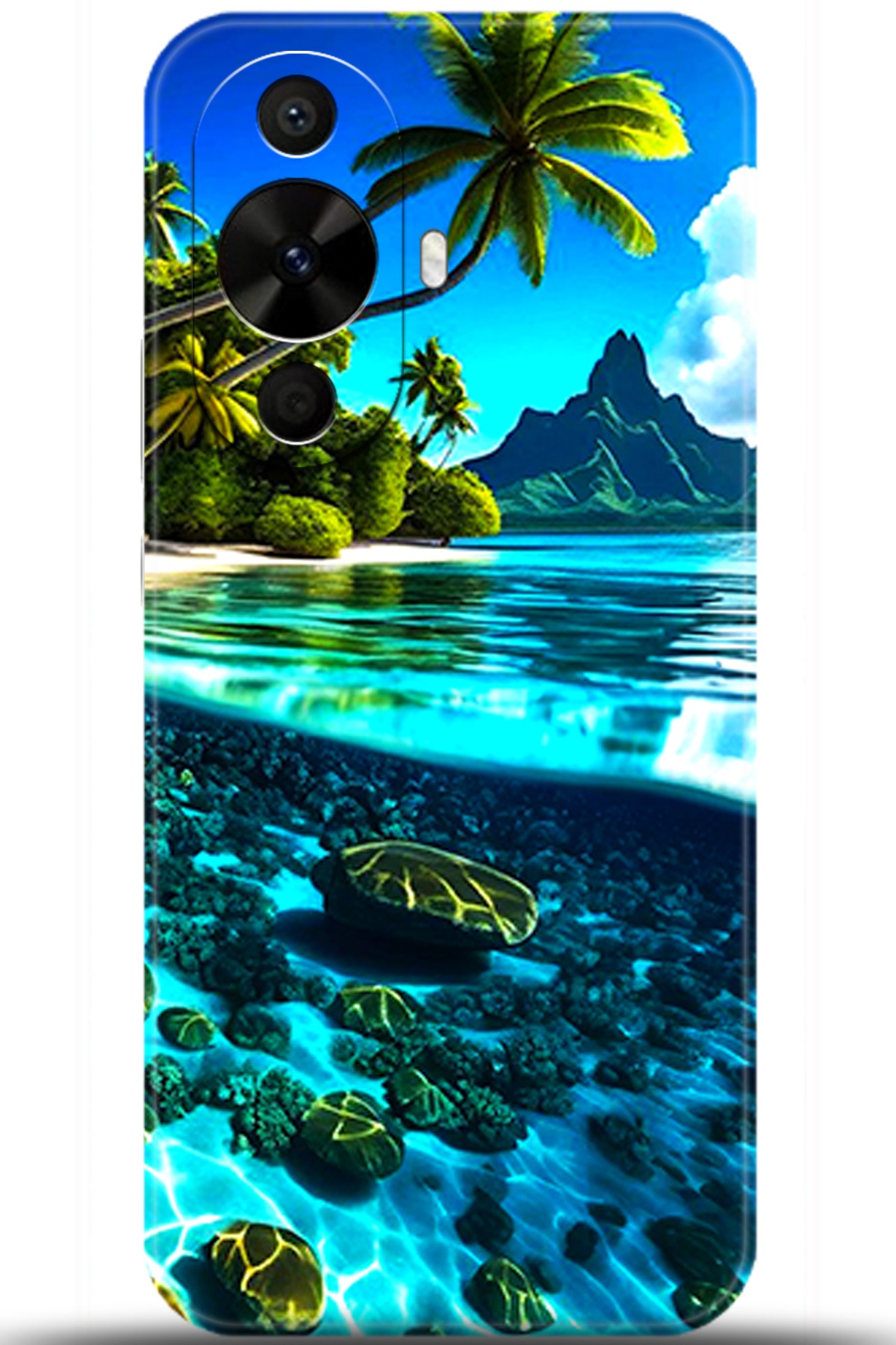 Huawei Nova 12s Uyumlu Kılıf HD Baskılı Kılıf - Followed Institution 5491