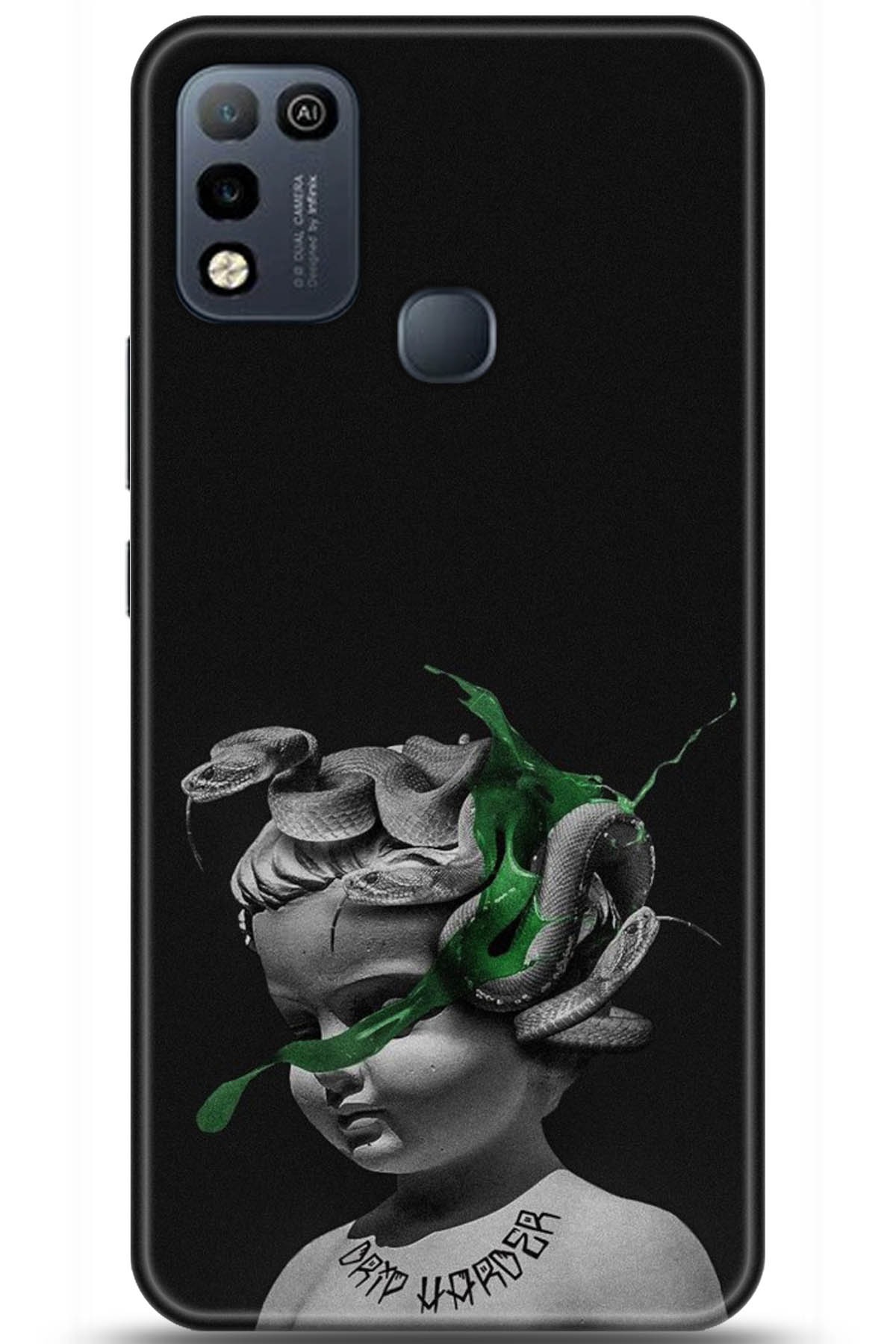 iNfinix Hot 10 Play Uyumlu Kılıf HD Baskılı Kılıf - Followed Institution 5077