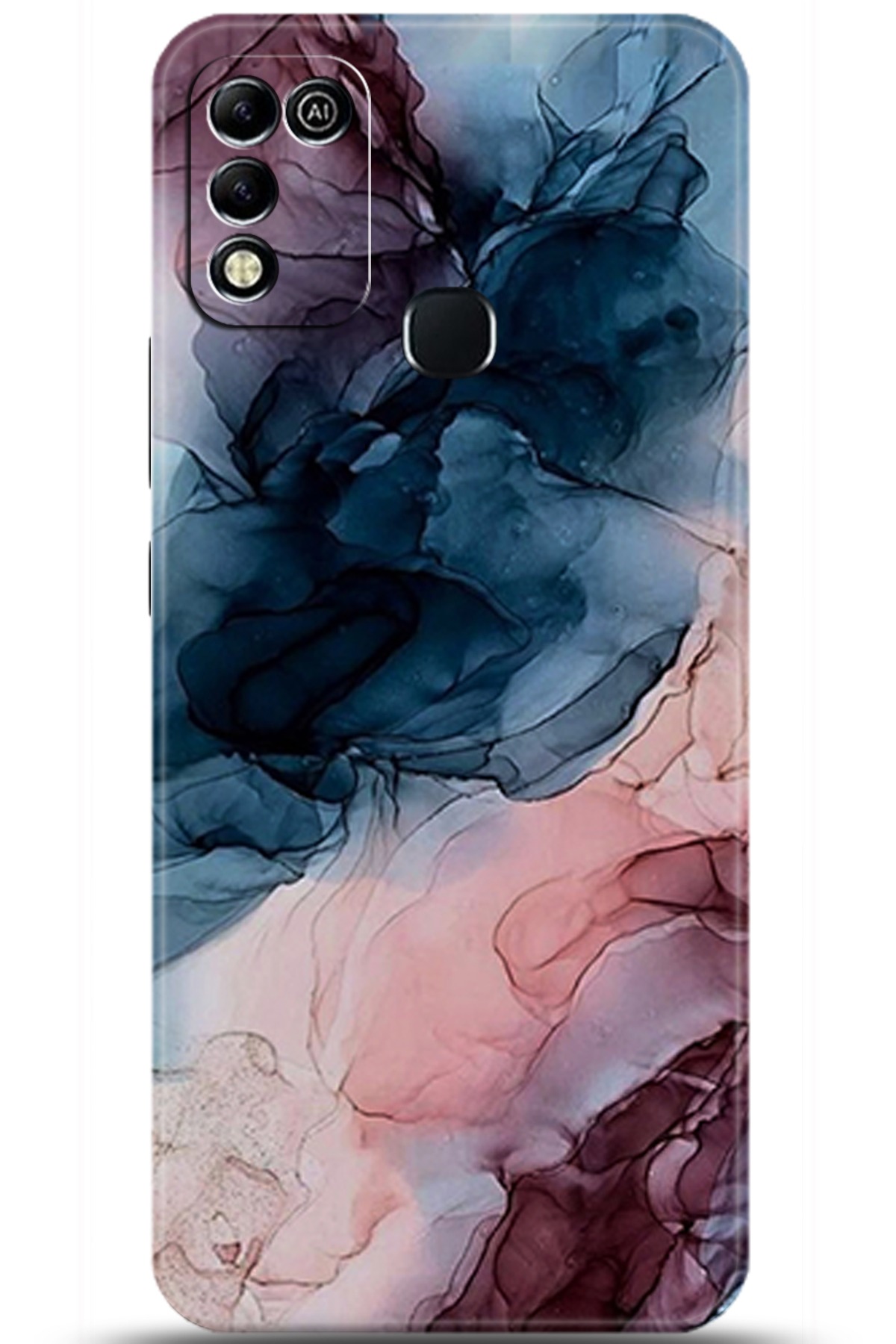 iNfinix Hot 11 Play Uyumlu Kılıf HD Baskılı Kılıf - Followed Institution 5985