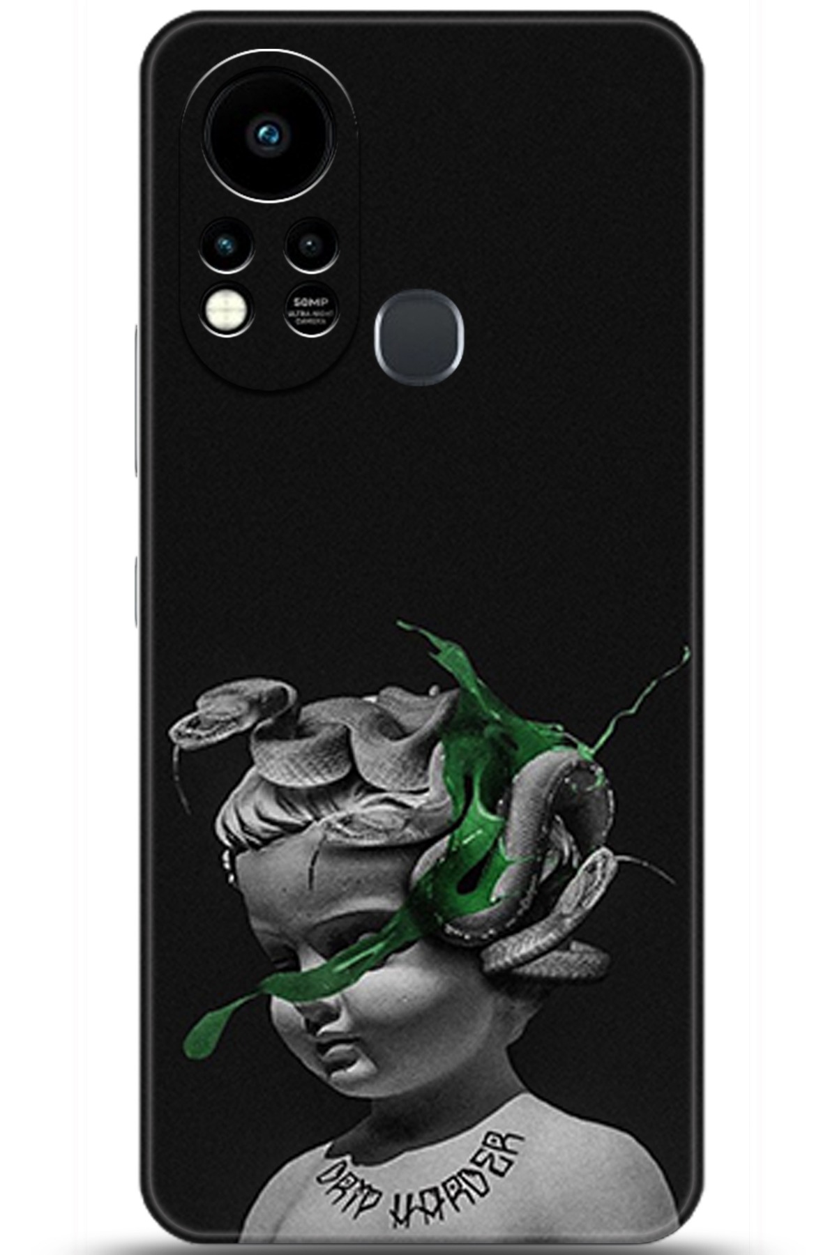 iNfinix Hot 11s Uyumlu Kılıf HD Baskılı Kılıf - Followed Institution 5077