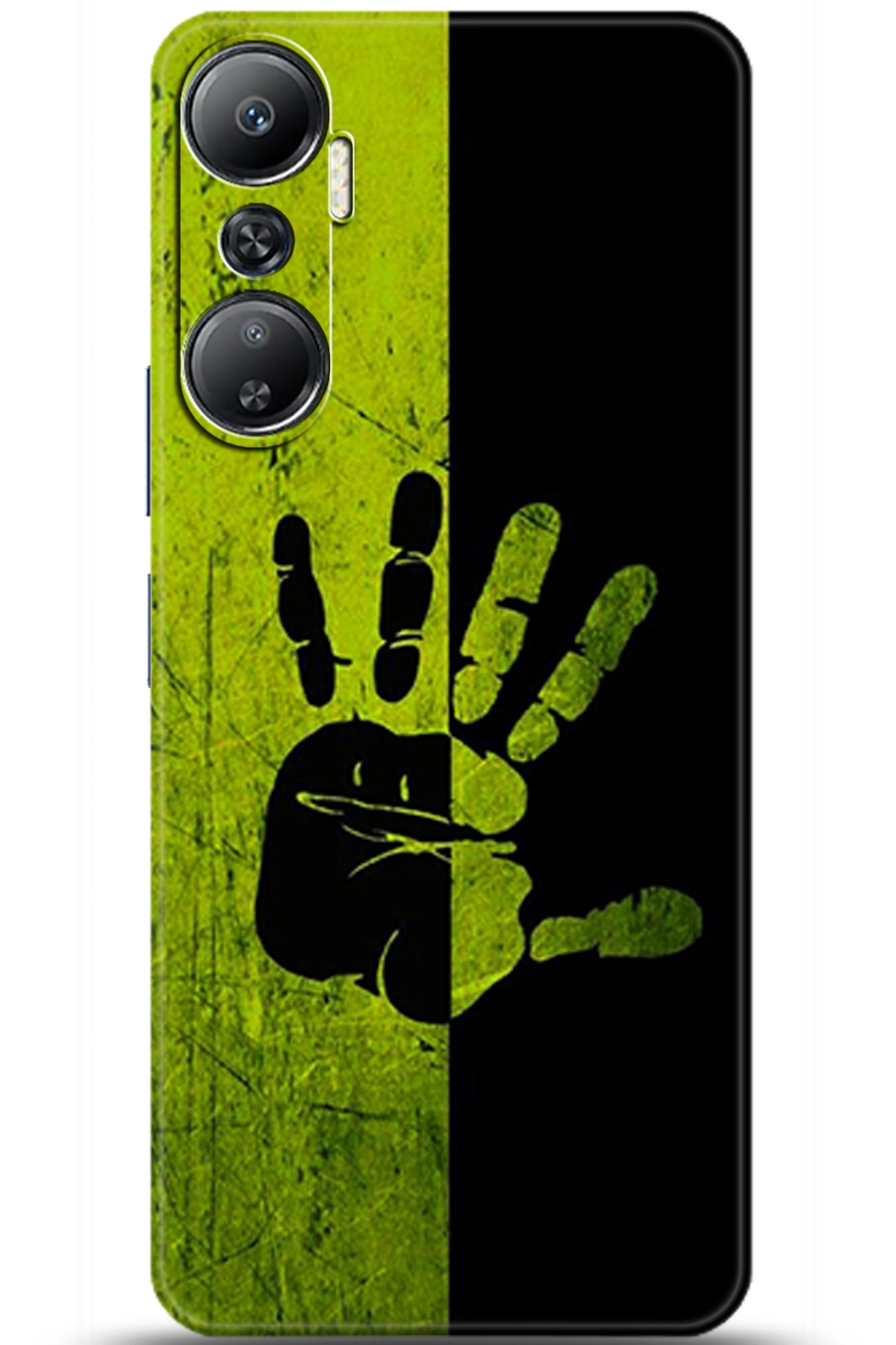 iNfinix Hot 20 Uyumlu Kılıf HD Baskılı Kılıf - Followed Institution 5870