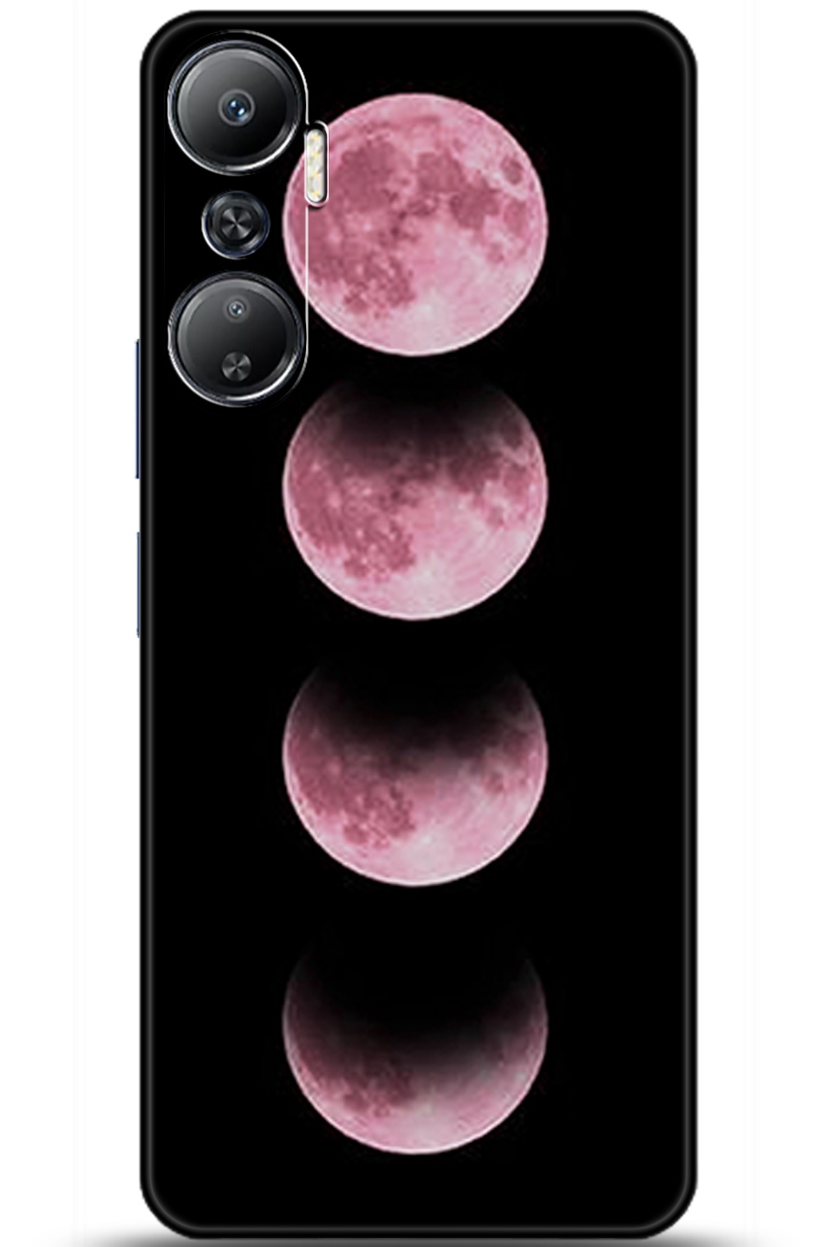 iNfinix Hot 20 Uyumlu Kılıf HD Baskılı Kılıf - Followed Institution 5915