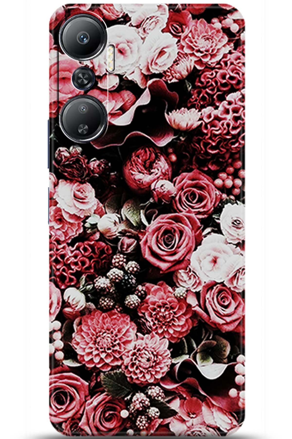 iNfinix Hot 20 Uyumlu Kılıf HD Baskılı Kılıf - Followed Institution 5926