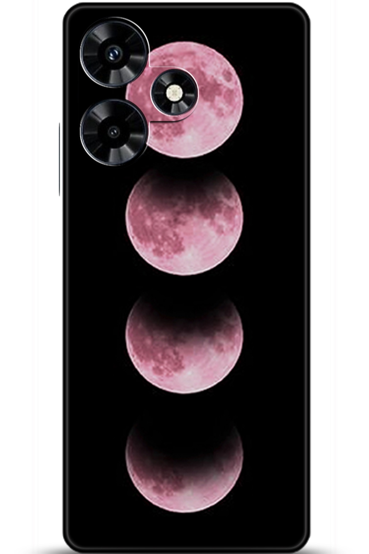 iNfinix Hot 30 Uyumlu Kılıf HD Baskılı Kılıf - Followed Institution 5915