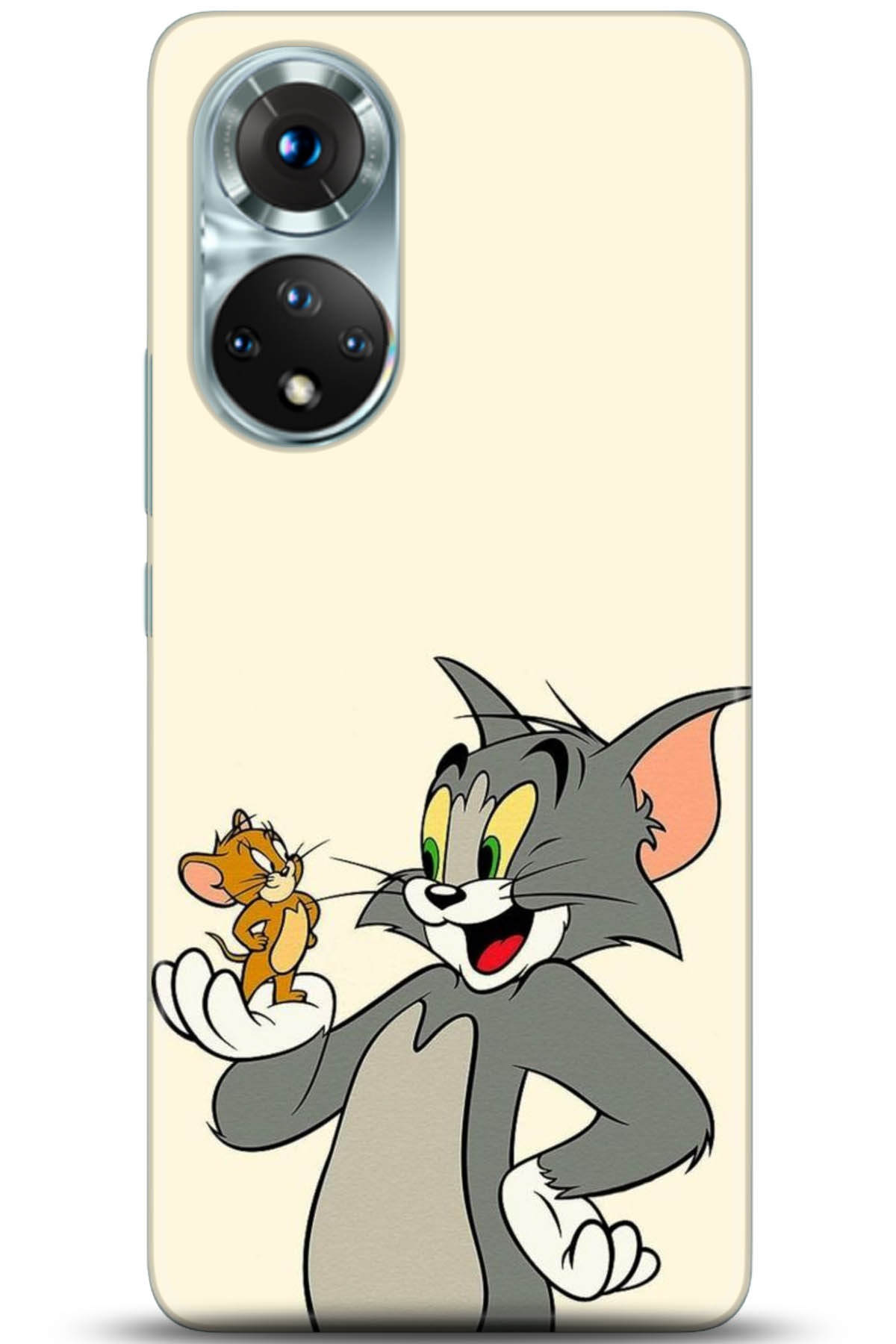 Honor 50 Kılıf HD Baskılı Kılıf - Followed Institution 5030