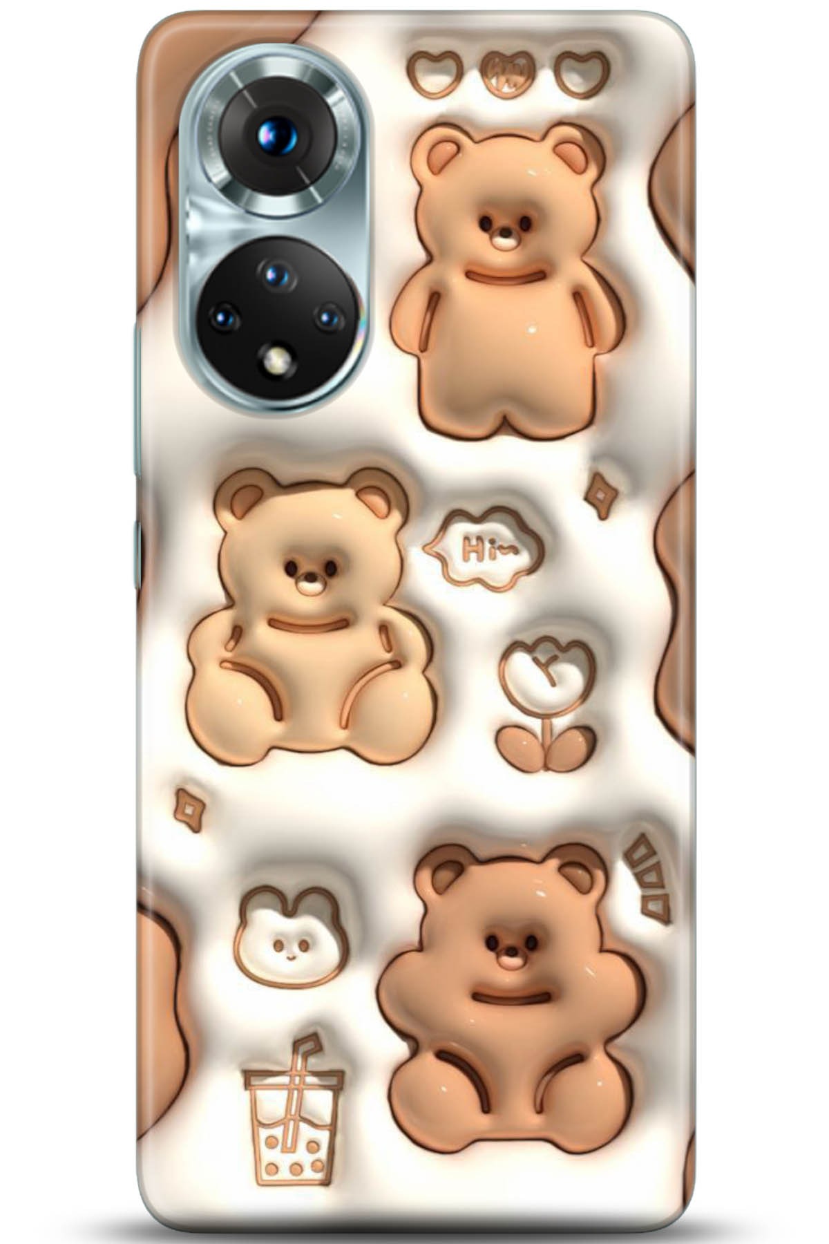 Honor 50 Kılıf HD Baskılı Kılıf - Followed Institution 5047