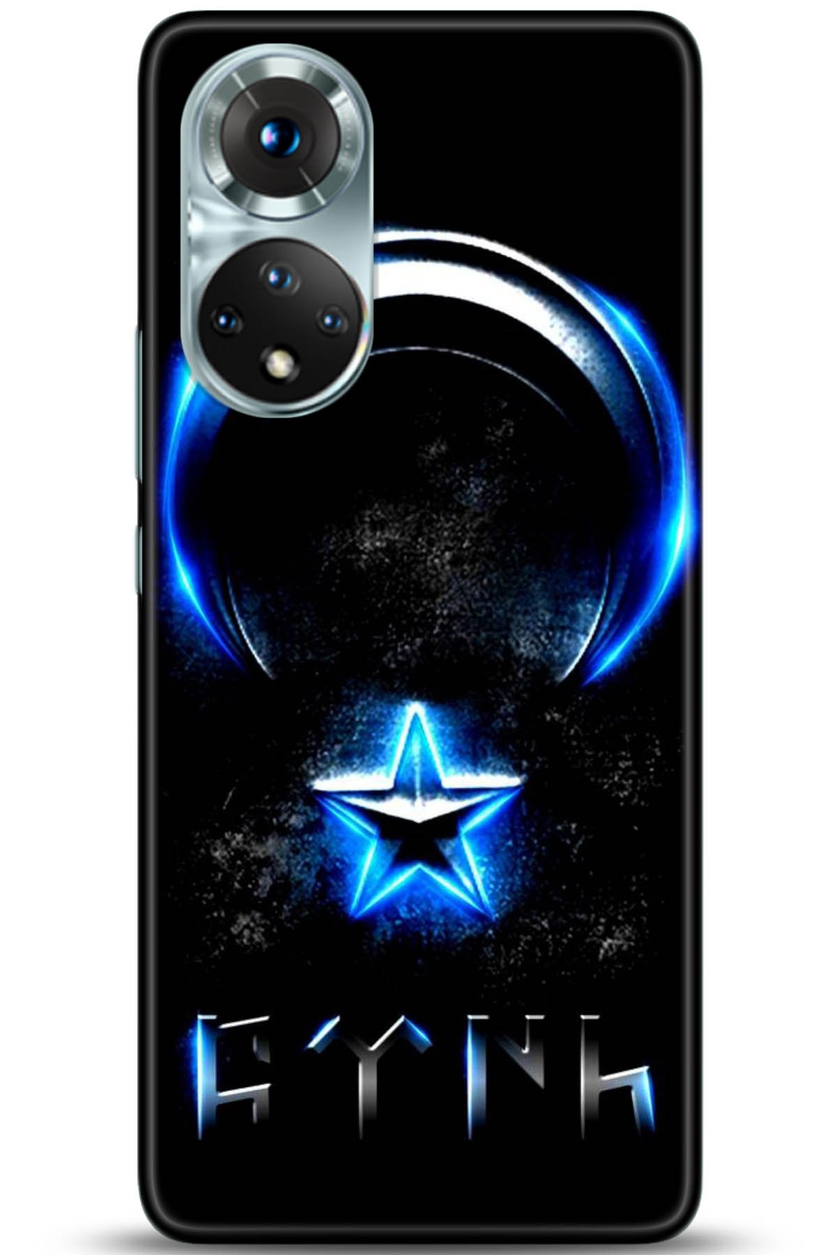 Honor 50 Kılıf HD Baskılı Kılıf - Followed Institution 5131