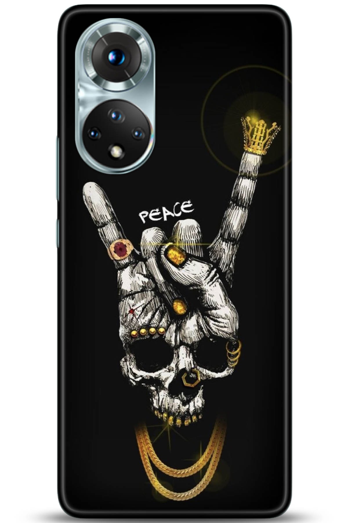 Honor 50 Kılıf HD Baskılı Kılıf - Followed Institution 5148