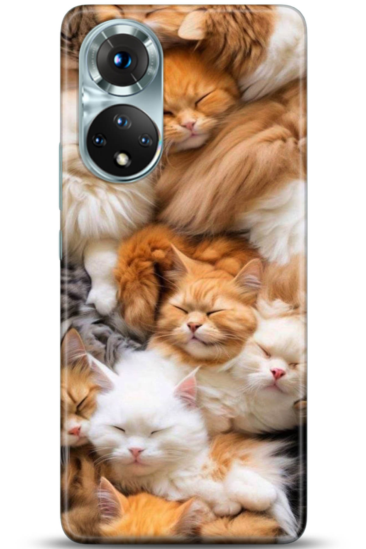 Honor 50 Kılıf HD Baskılı Kılıf - Followed Institution 5234