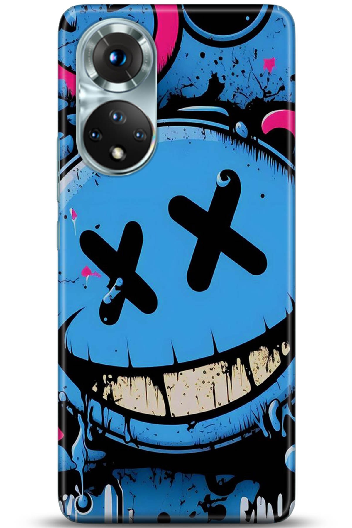 Honor 50 Kılıf HD Baskılı Kılıf - Followed Institution 5261