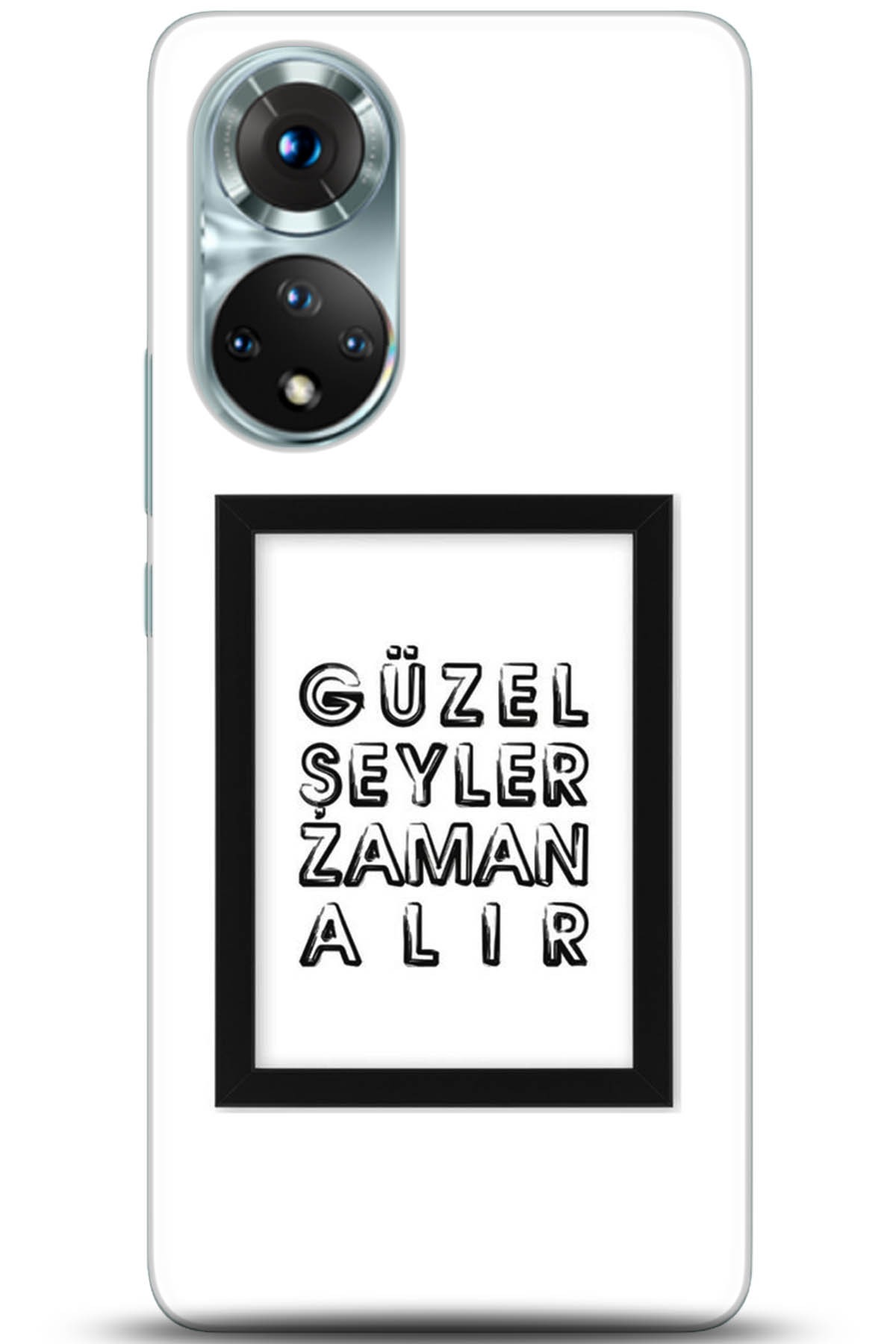 Honor 50 Kılıf HD Baskılı Kılıf - Followed Institution 5307