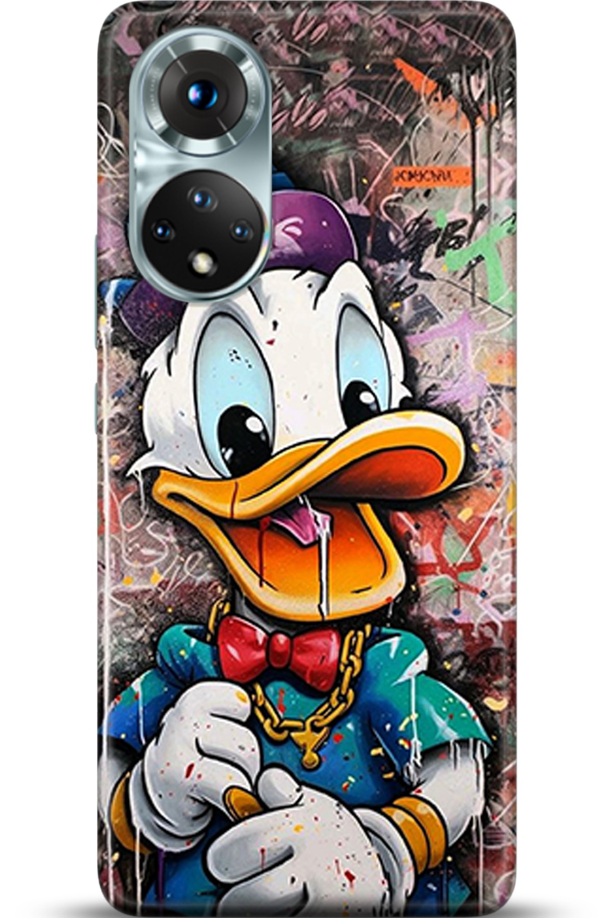 Honor 50 Kılıf HD Baskılı Kılıf - Followed Institution 5338