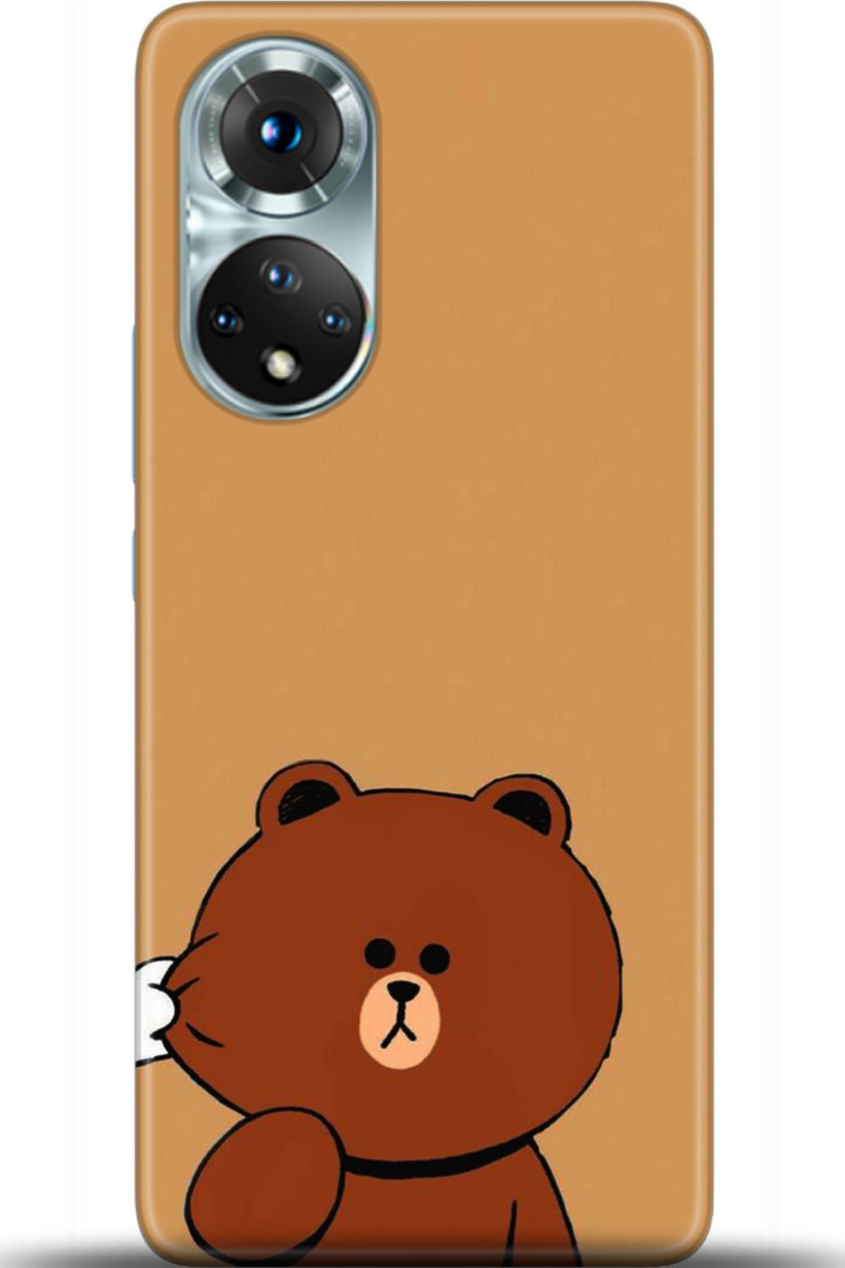 Honor 50 Kılıf HD Baskılı Kılıf - Followed Institution 5417