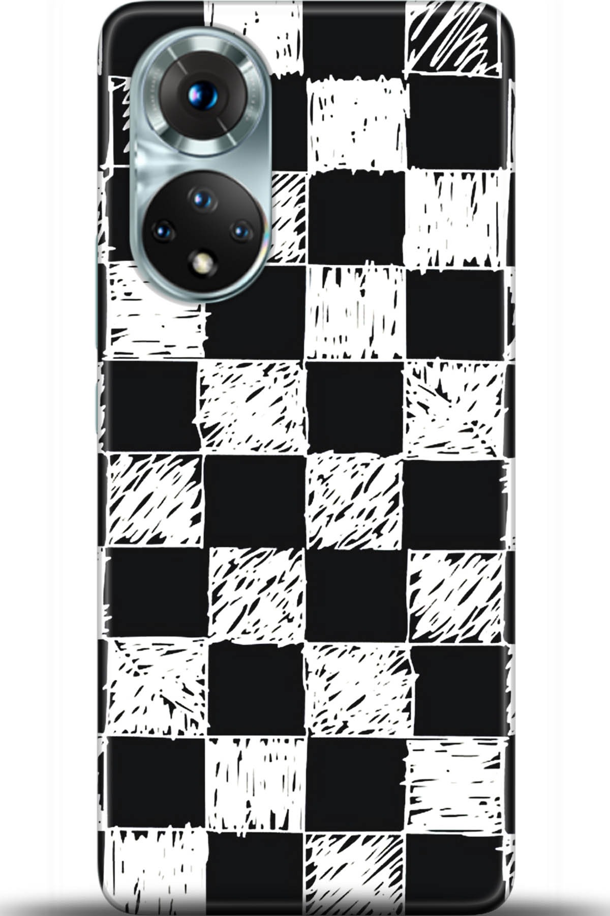 Honor 50 Kılıf HD Baskılı Kılıf - Followed Institution 5483