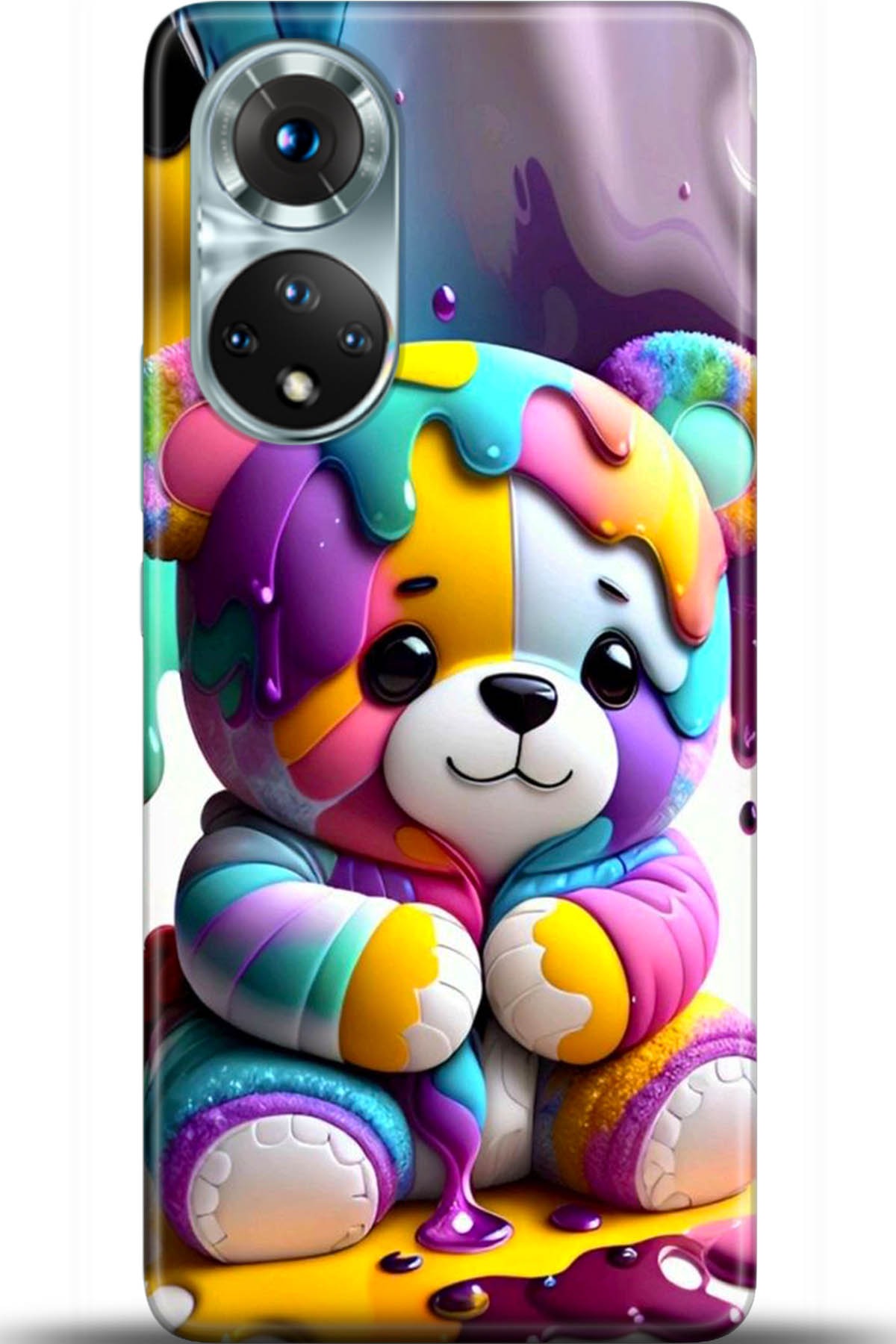 Honor 50 Kılıf HD Baskılı Kılıf - Followed Institution 5493