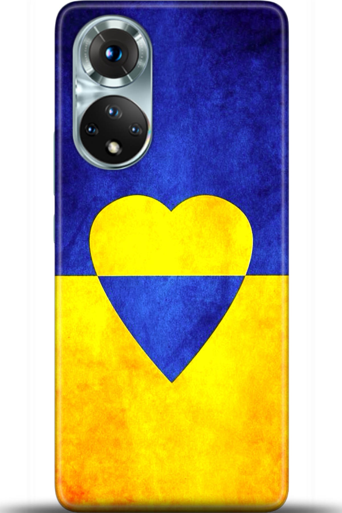 Honor 50 Kılıf HD Baskılı Kılıf - Followed Institution 5581