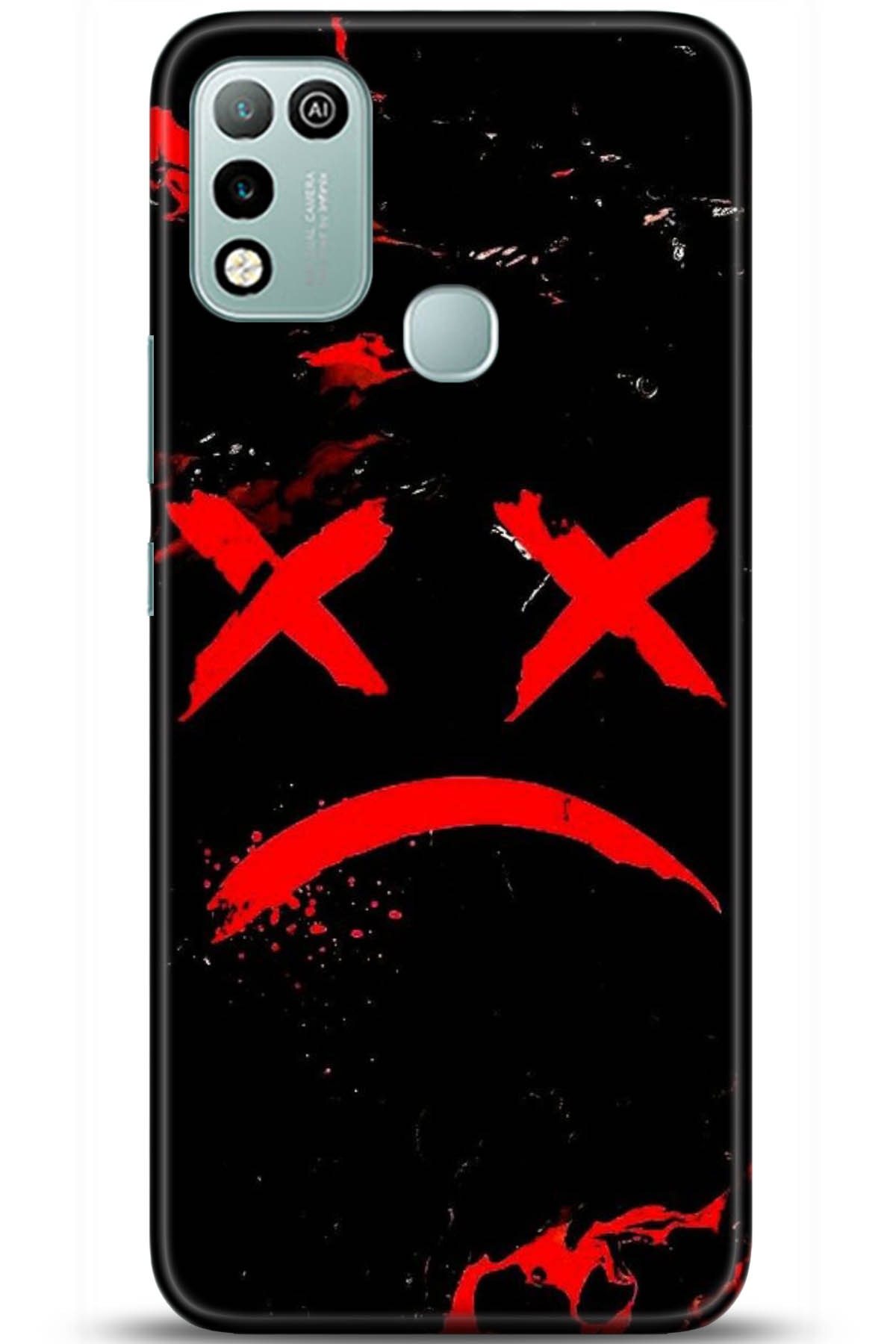 iNfinix Hot 10 Uyumlu Kılıf HD Baskılı Kılıf - Followed Institution 5139