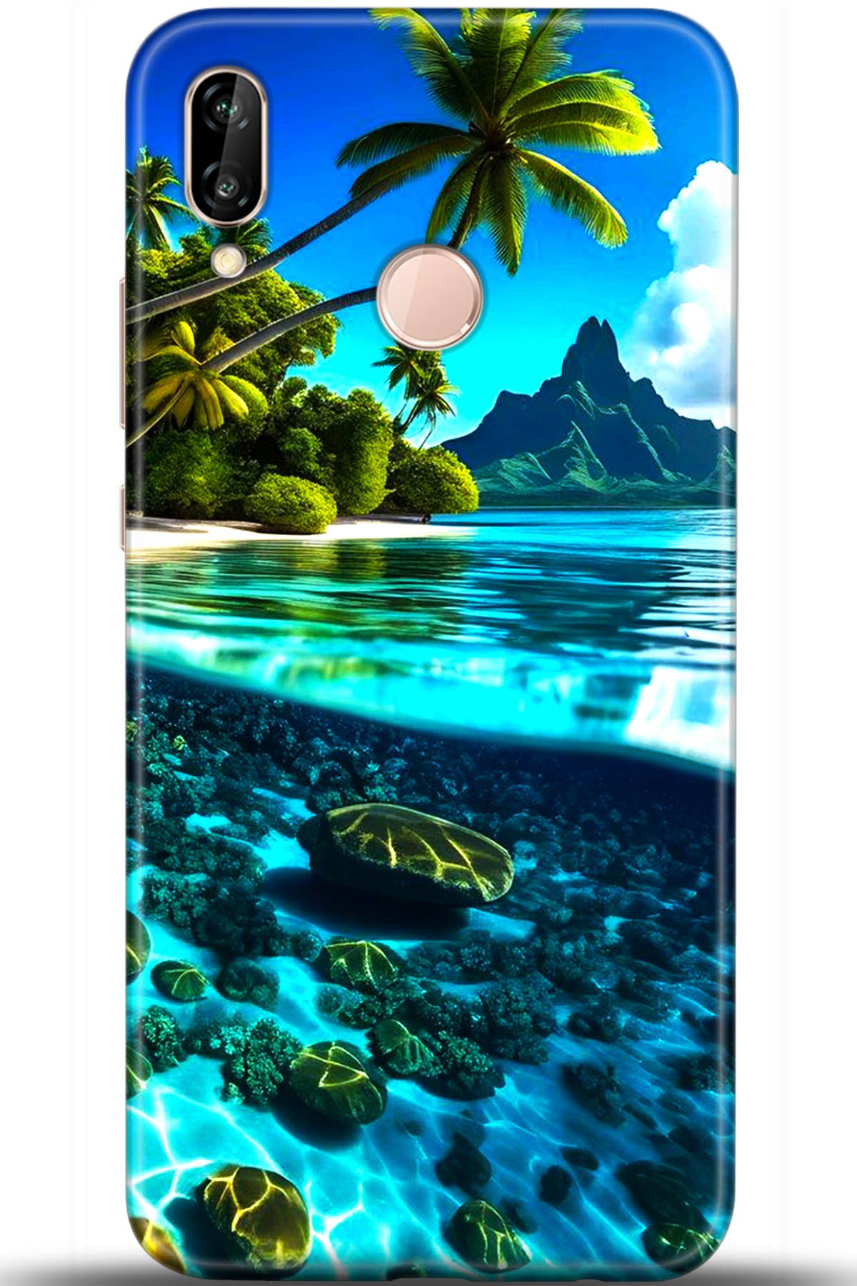 Huawei P20 Lite Uyumlu Kılıf HD Baskılı Kılıf - Followed Institution 5491