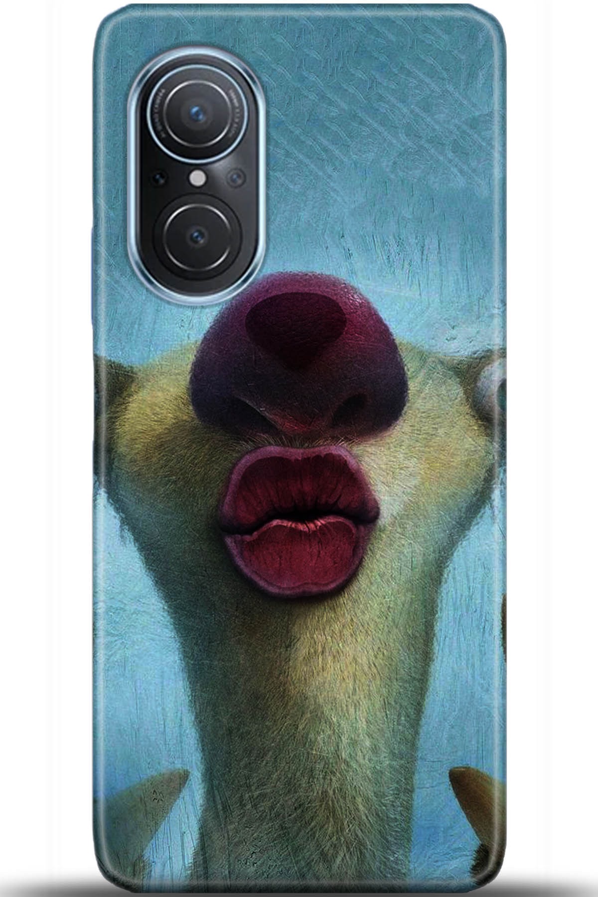 Huawei Nova 9 Uyumlu Kılıf HD Baskılı Kılıf - Followed Institution 5372