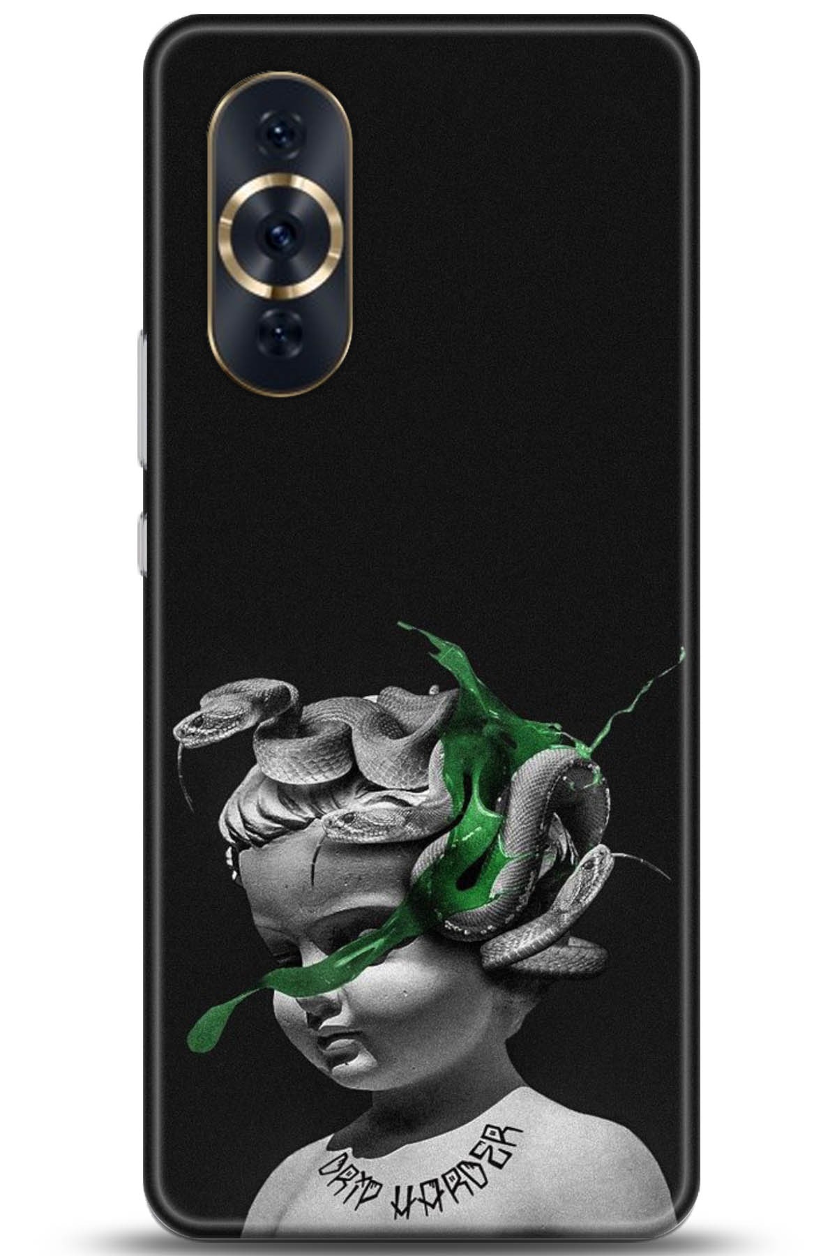 Huawei Nova 10 Pro Uyumlu Kılıf HD Baskılı Kılıf - Followed Institution 5077