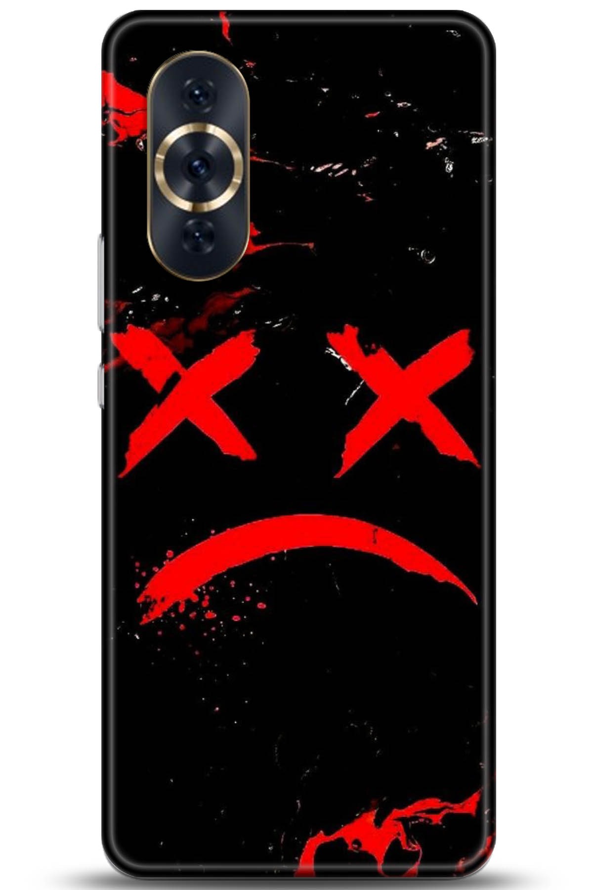 Huawei Nova 10 Pro Uyumlu Kılıf HD Baskılı Kılıf - Followed Institution 5139