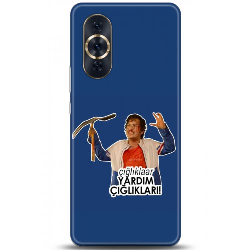 Uyumlu Kılıf HD Baskılı Kılıf - Followed Institution 5157