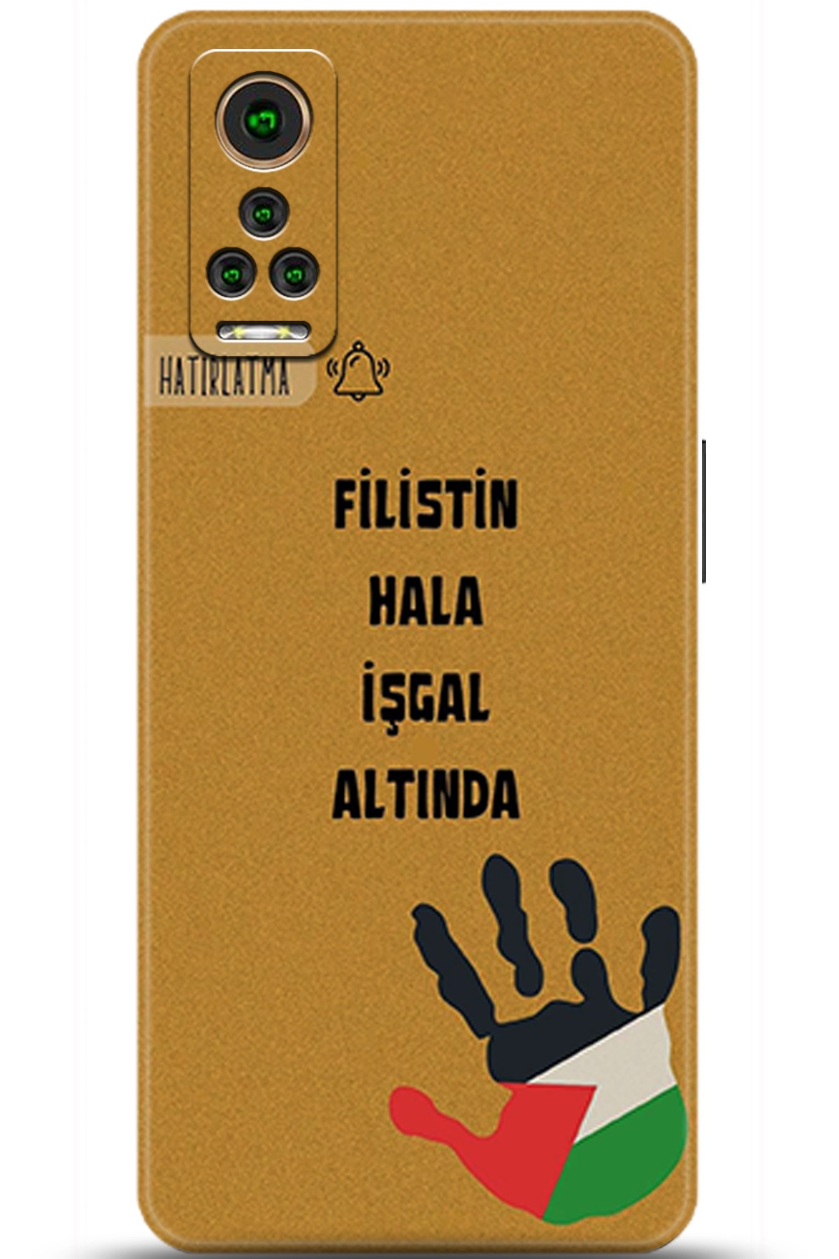 General Mobile GM 22 Pro Uyumlu Kılıf HD Baskılı Kılıf - Followed Institution 5740