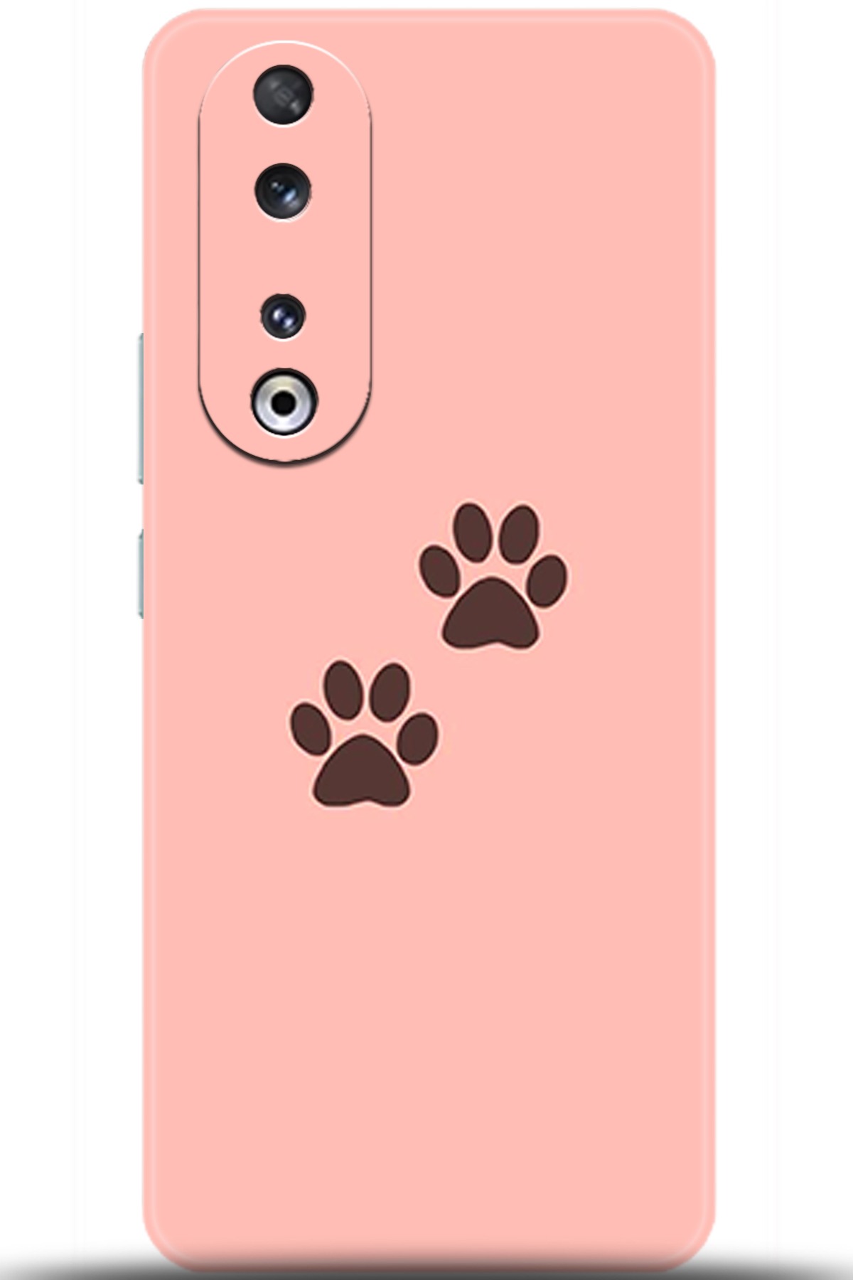 Honor 90 Uyumlu Kılıf HD Baskılı Kılıf - Followed Institution 5615